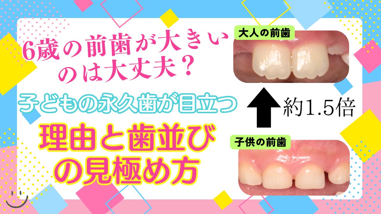 6歳の前歯が大きいのは大丈夫？子どもの永久歯が目立つ理由と歯並びの見極め方