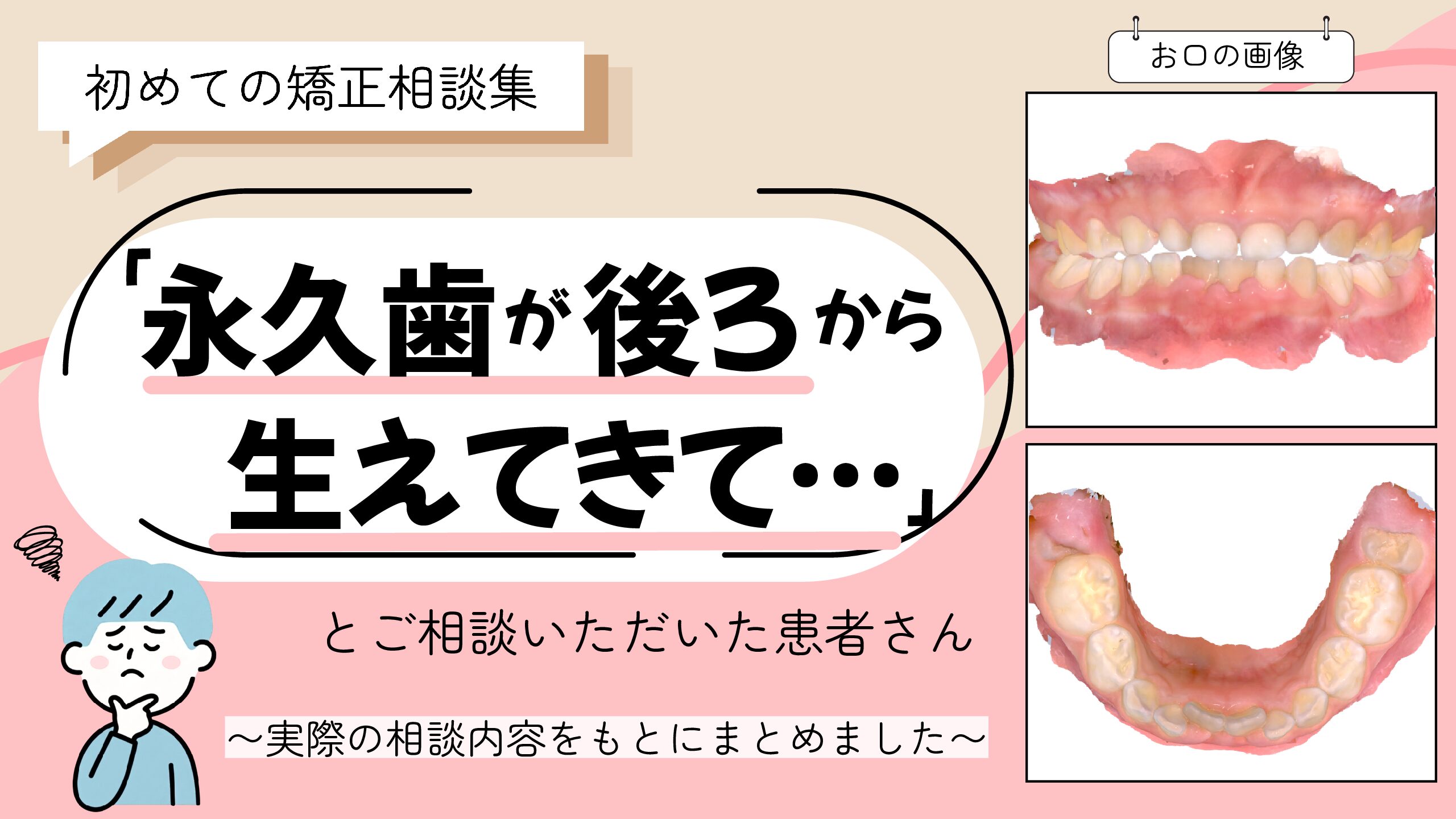 「永久歯が後ろから生えてきていて…」とご相談いただいたH.Sさん（5歳・男の子）のケース