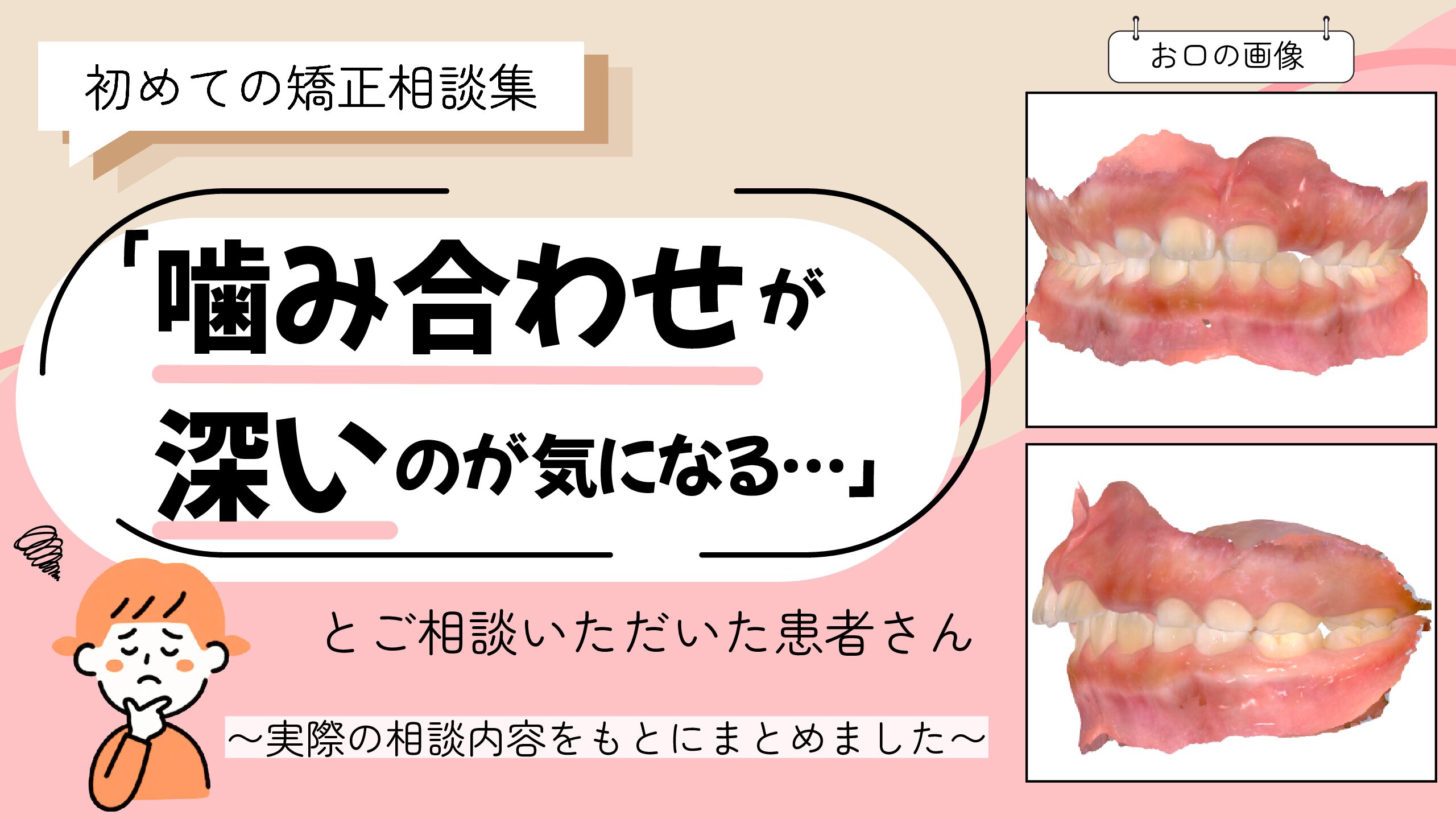 「噛み合わせが深いのが気になる…」とご相談いただいた 7歳・女の子のケース