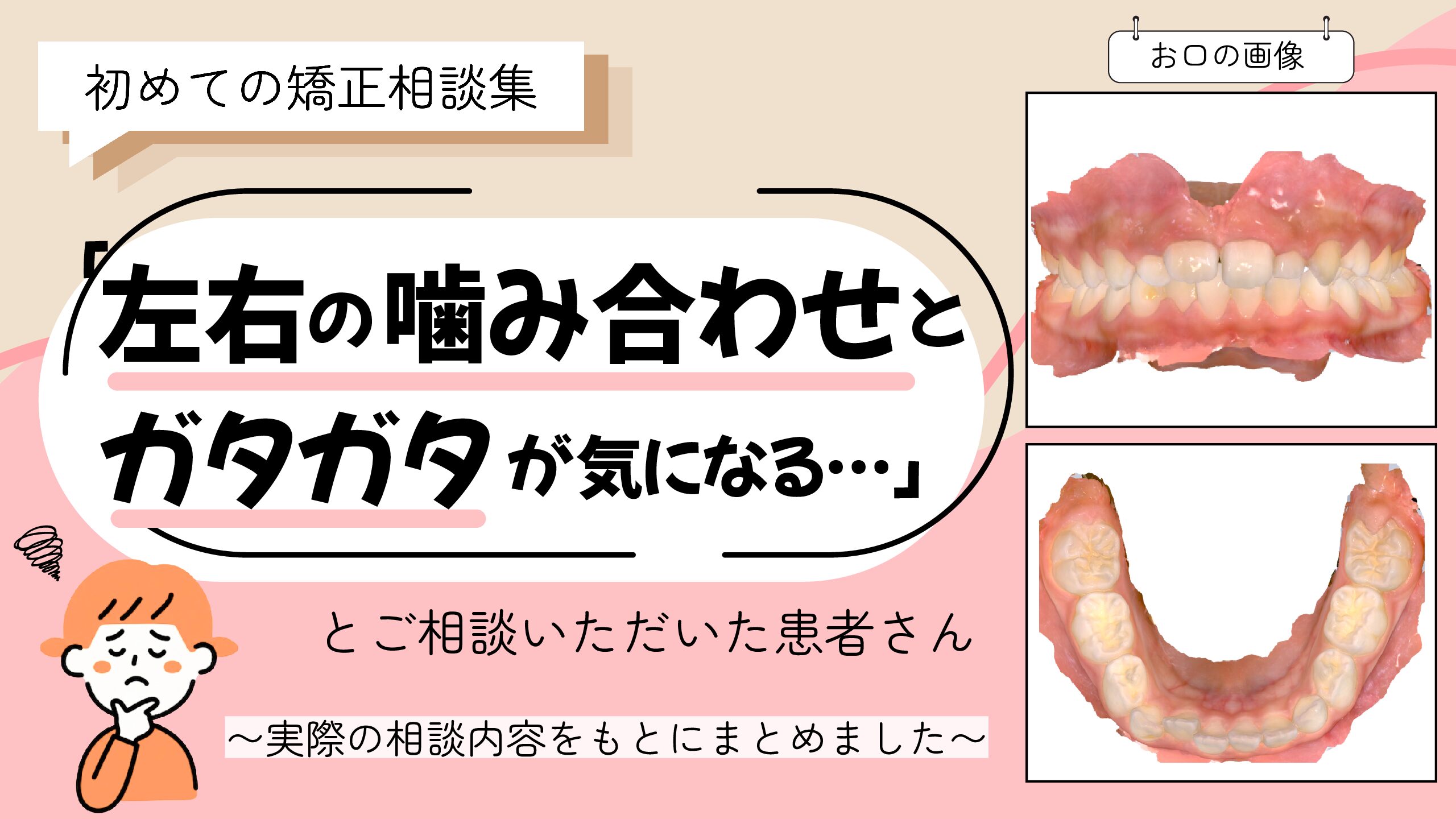 「左右の噛み合わせのズレとガタガタが気になる…」とご相談いただいたK.Yさん（8歳・女の子）のケース