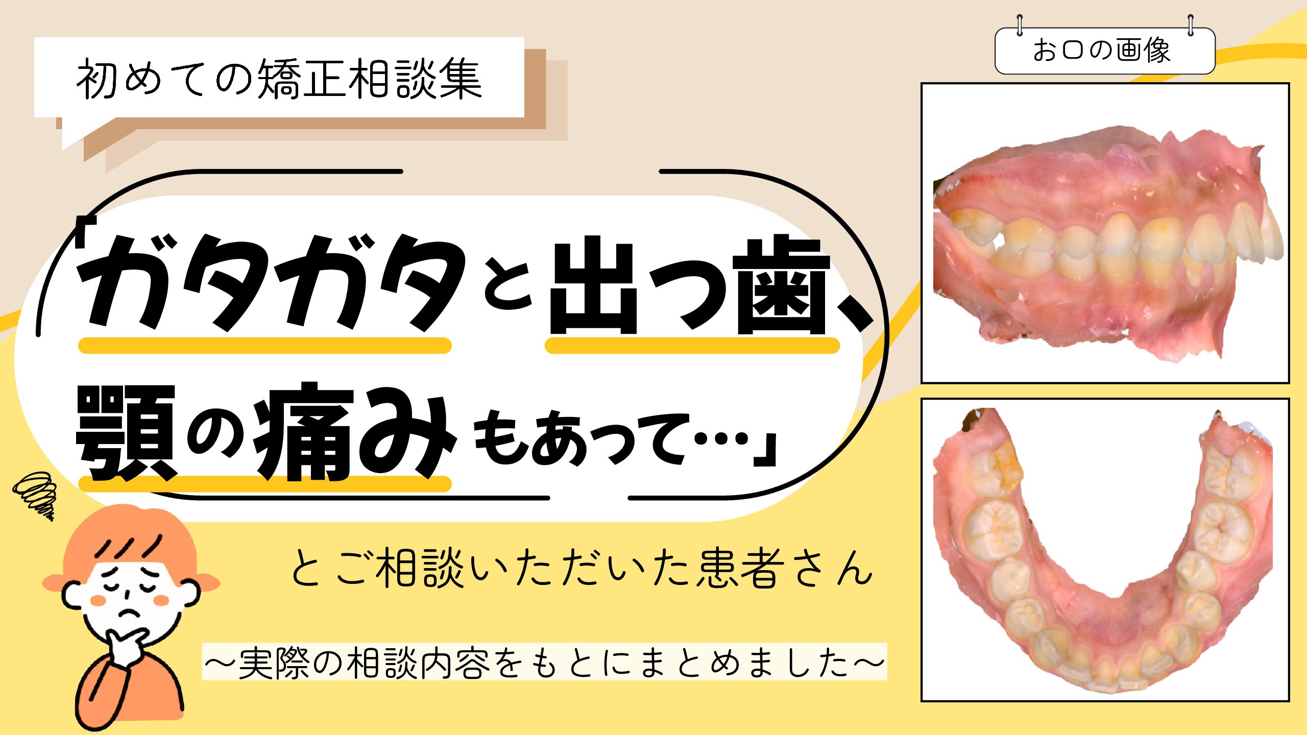 「ガタガタと出っ歯、顎の痛みもあって…」とご相談いただいたNさん（14歳・女の子）のケース