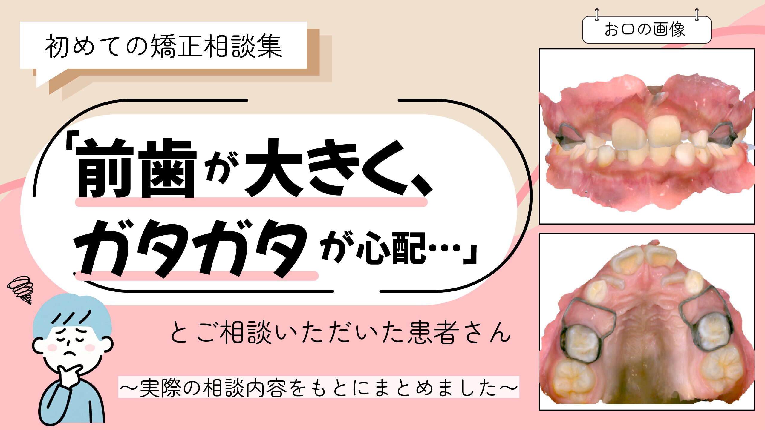 「前歯が大きく、ガタガタが心配…」とご相談いただいたT.Nさん（9歳・男の子）のケース