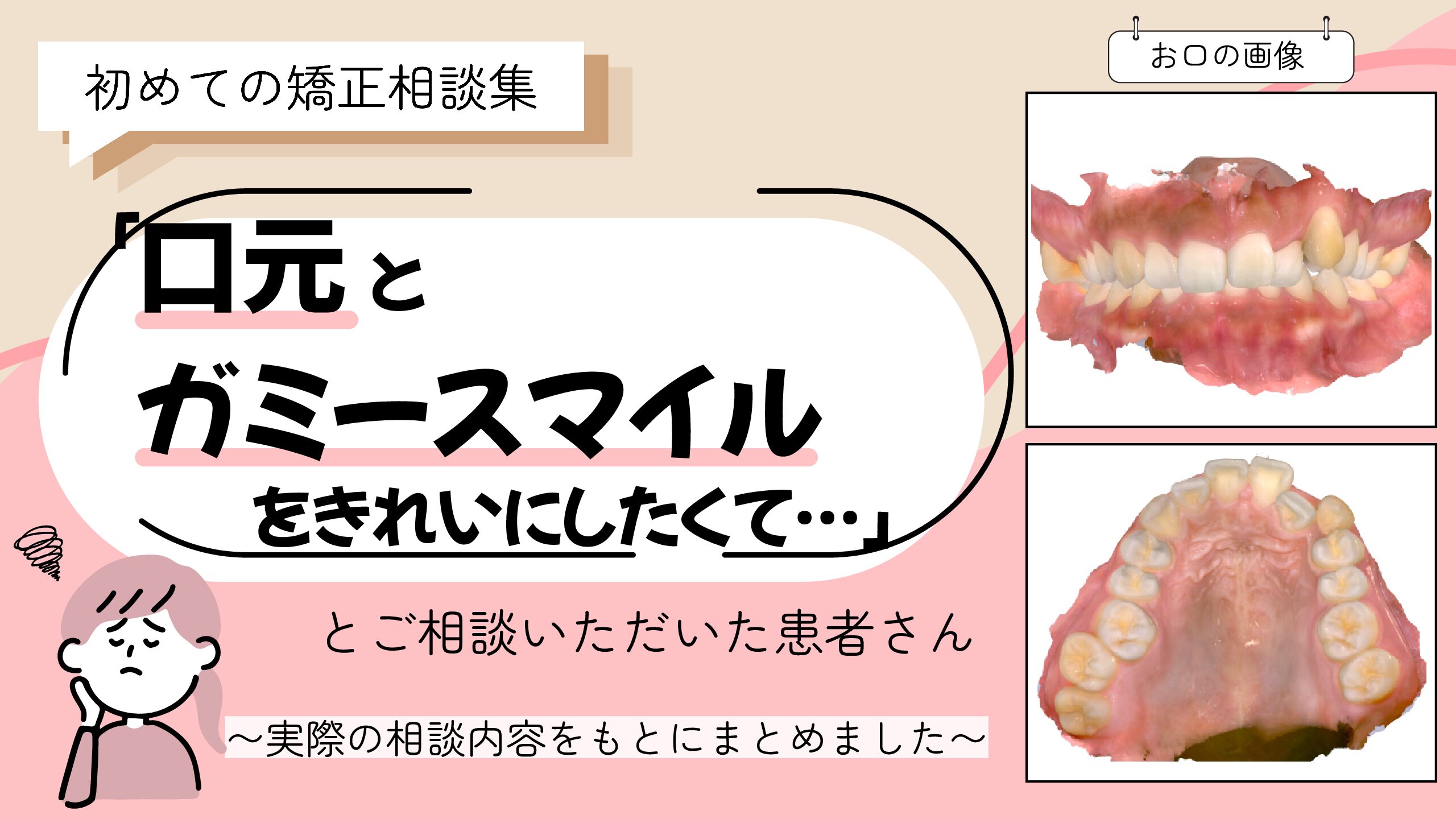 「口元とガミースマイルを、もう少しきれいにしたくて…」とご相談いただいたA.Mさん（26歳・女性）のケース