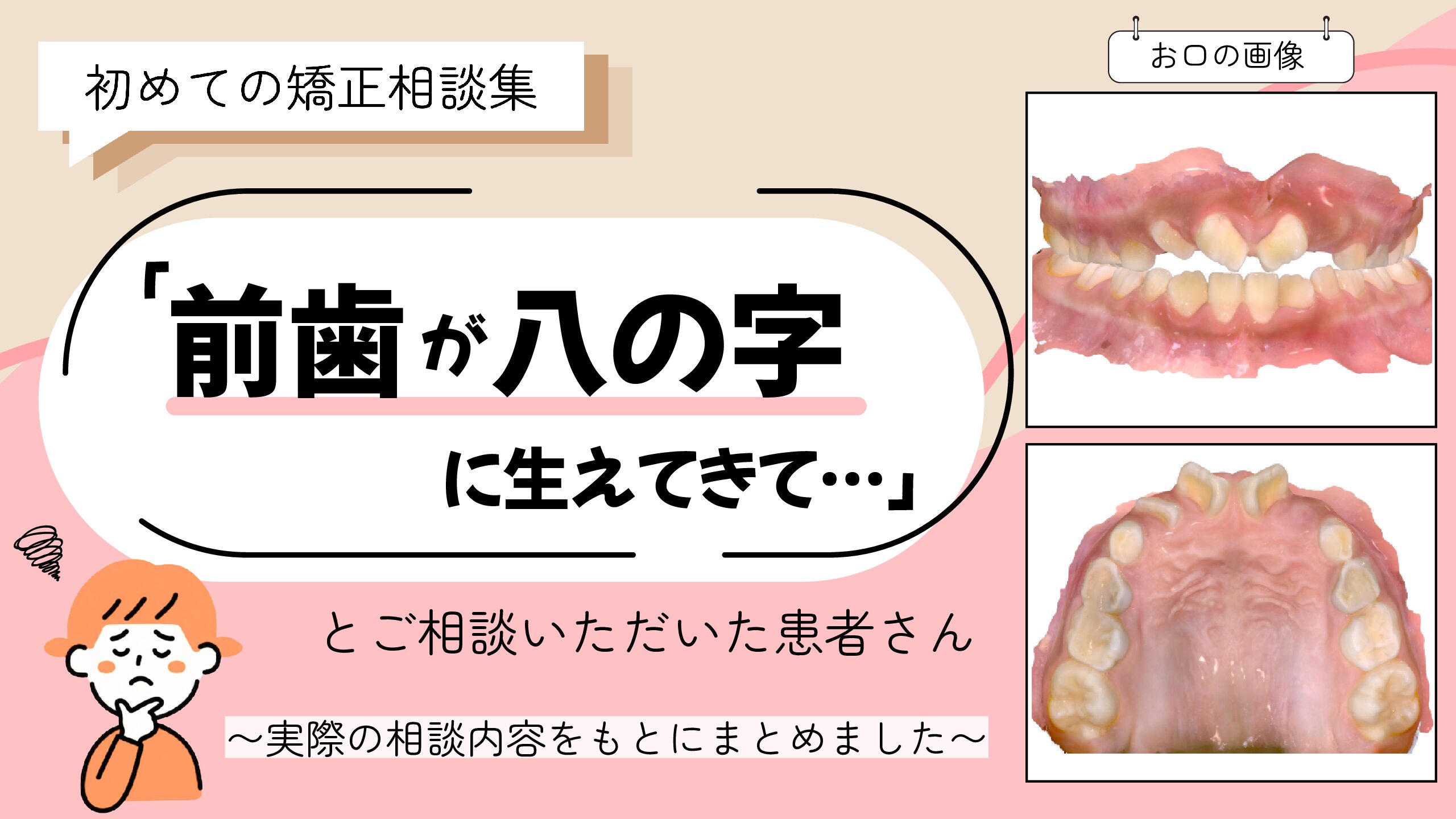 「前歯がハの字に生えてきて…」とご相談いただいたA.Uさん（8歳・女の子）のケース