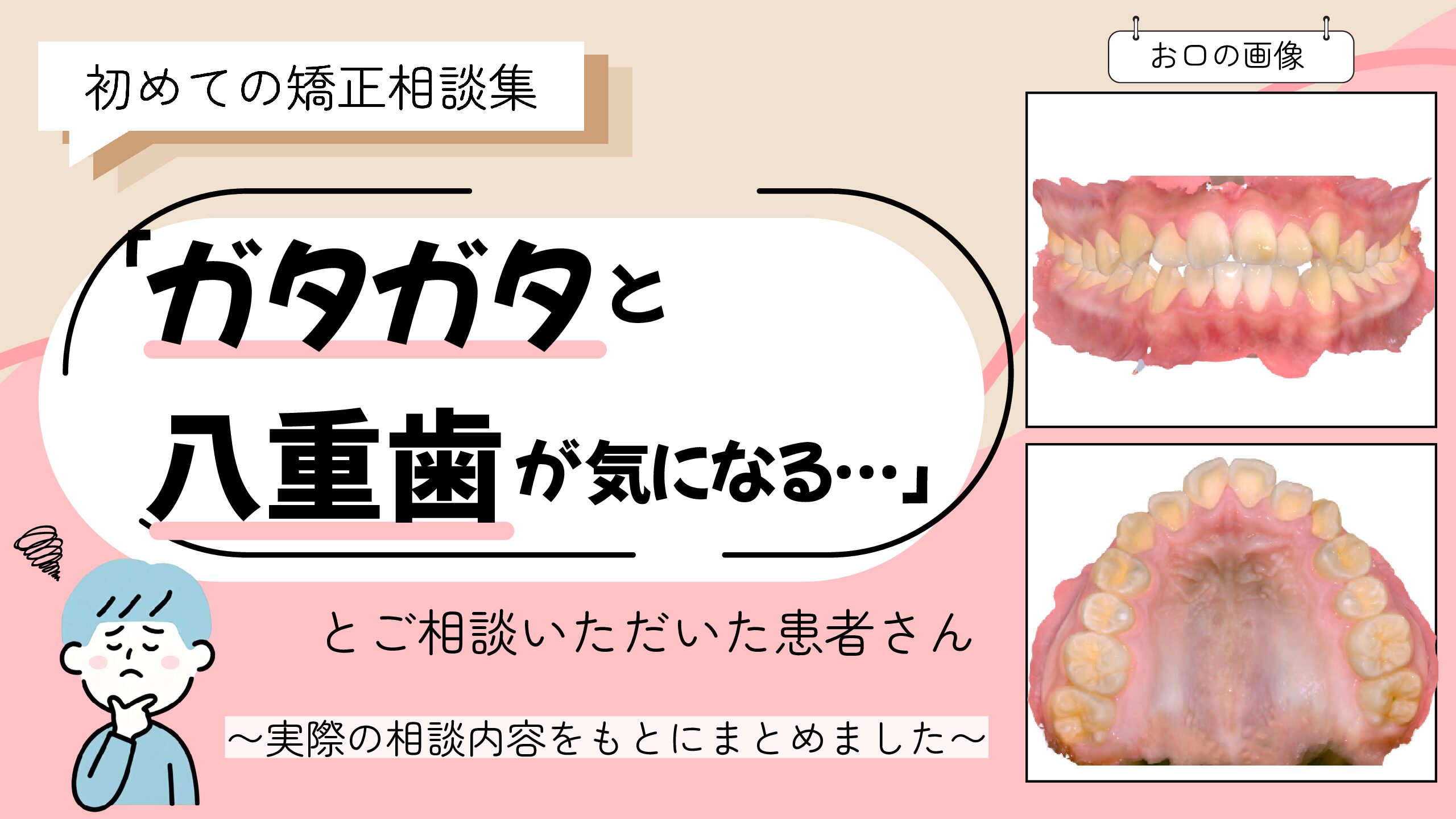 「ガタガタと八重歯が気になる…」とご相談いただいたK.Tさん（12歳・男の子）のケース