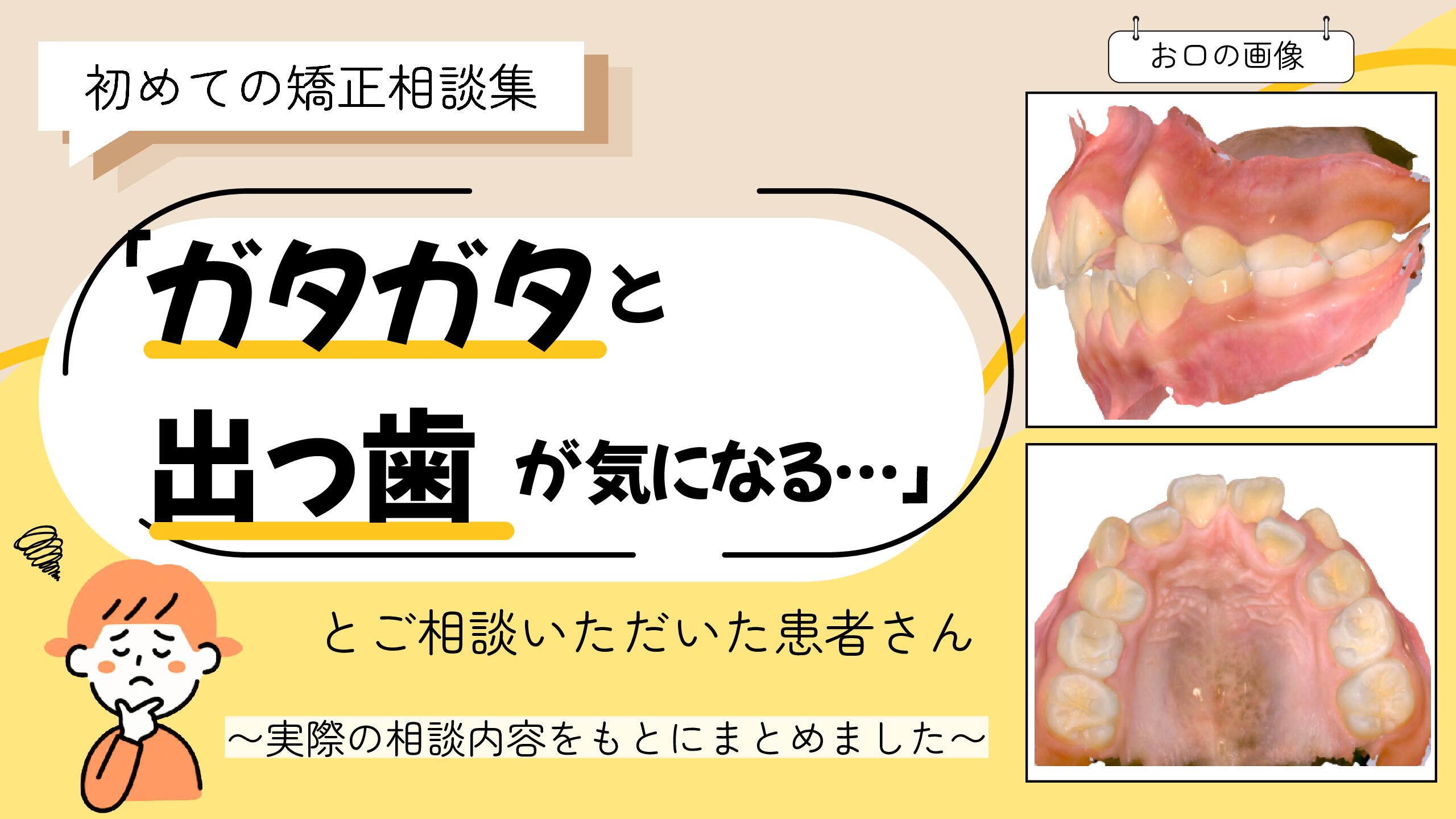 「ガタガタと出っ歯が気になる…」とご相談いただいたS.Iさん（10歳・女の子）のケース