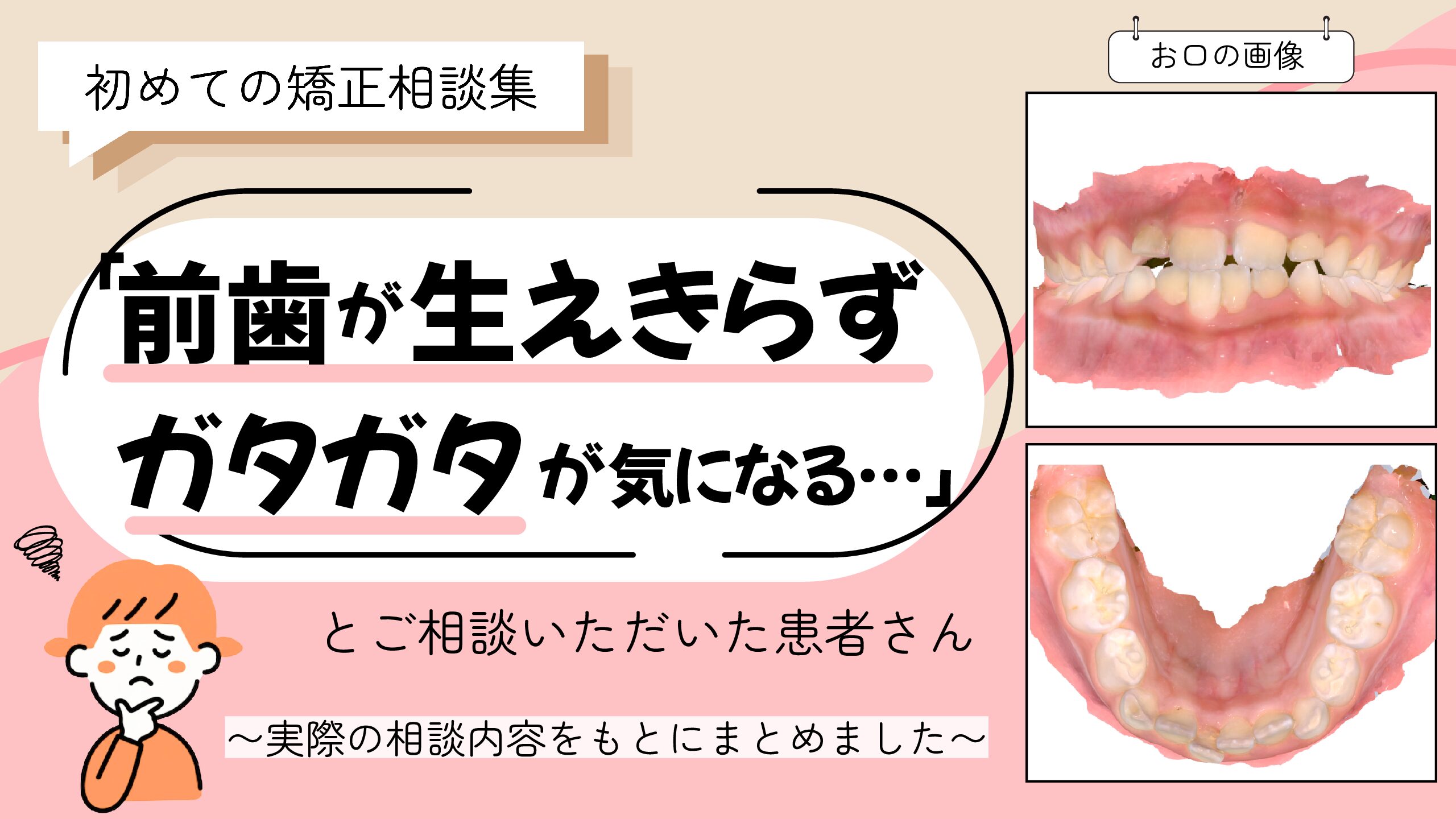 「前歯が生えきらず、ガタガタが気になる…」とご相談いただいたF.Iさん（7歳・女の子）のケース