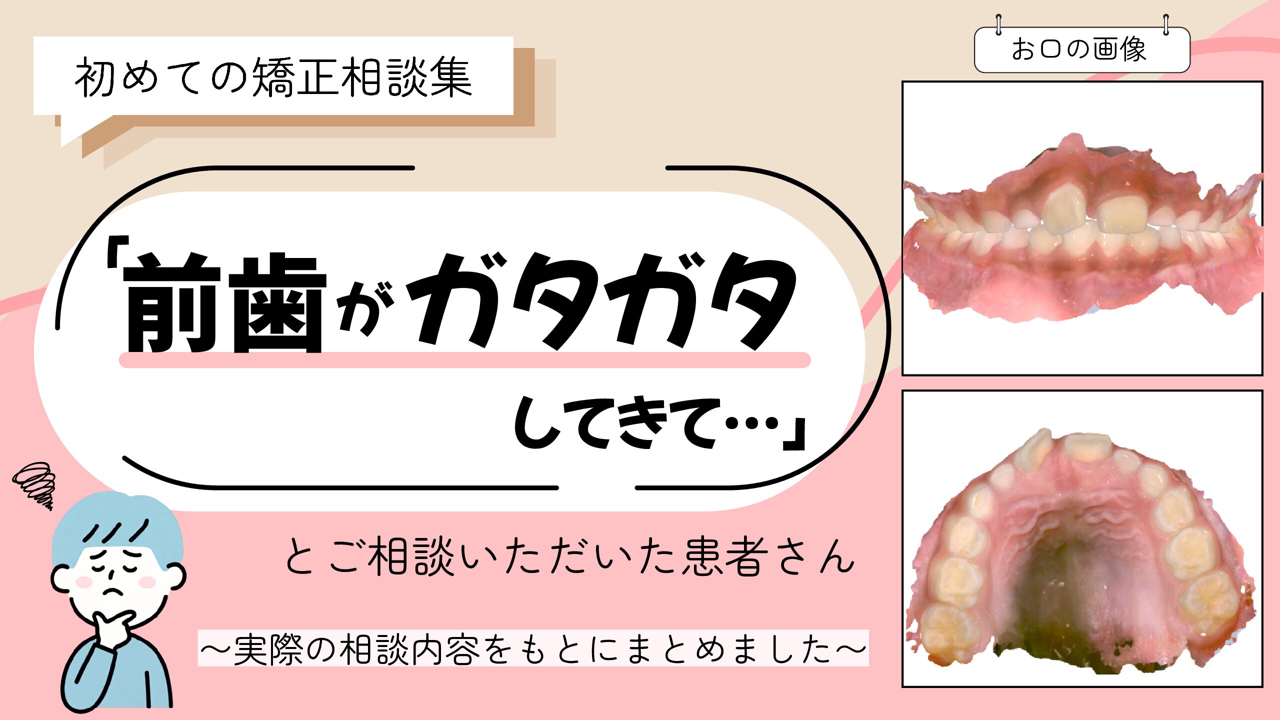 「前歯がガタガタしてきて…」とご相談いただいたK.Hさん（7歳・男の子）のケース