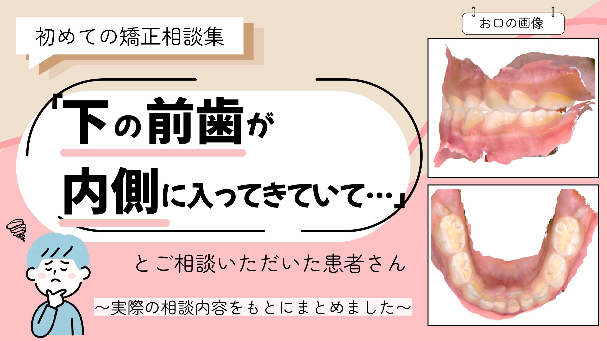 「下の前歯が内側に入ってきていて…」とご相談いただいたI.Yさん（6歳・男の子）のケース