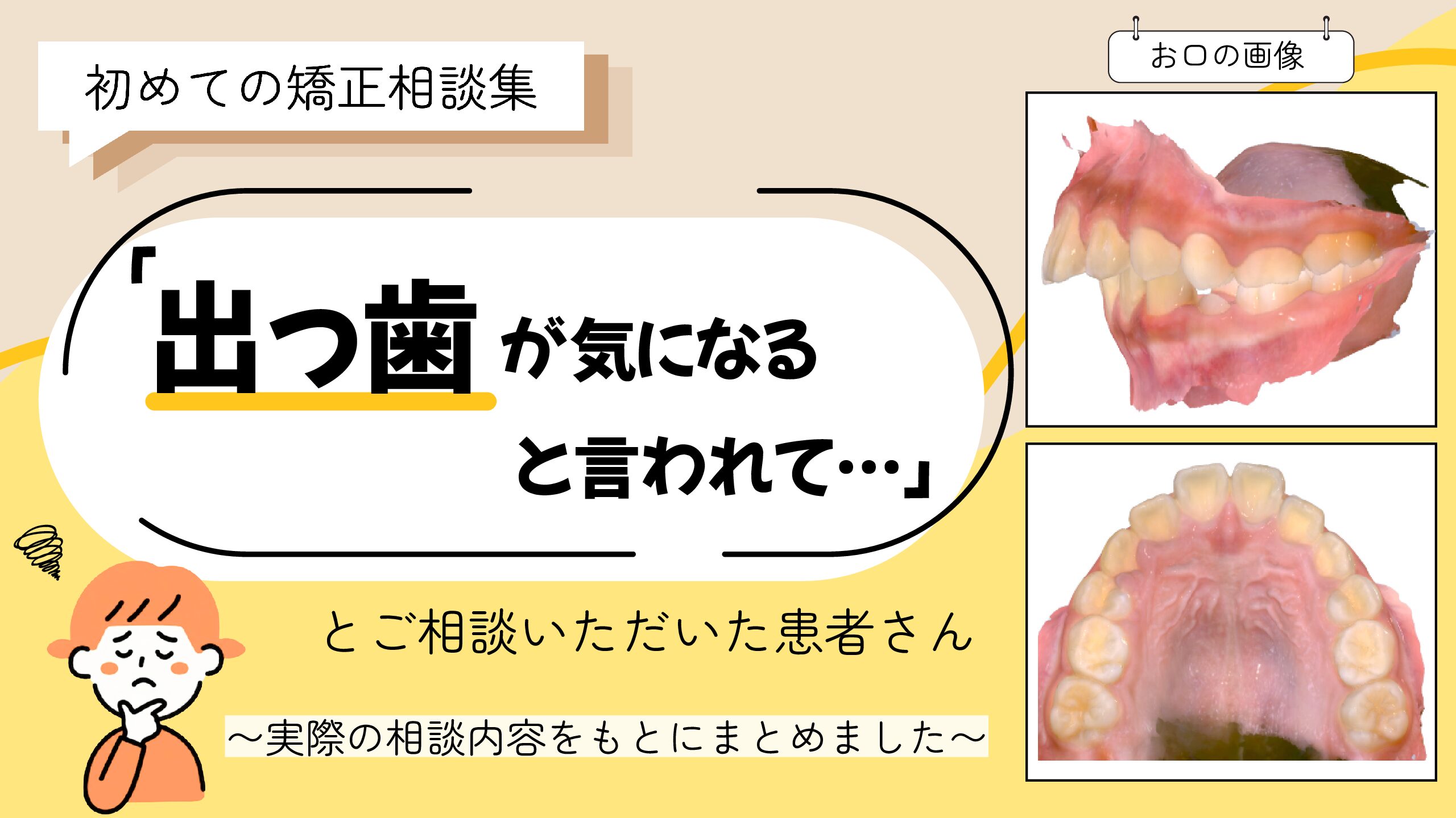 「出っ歯が気になると言われて…」とご相談いただいたM.Hさん（9歳・女の子）のケース