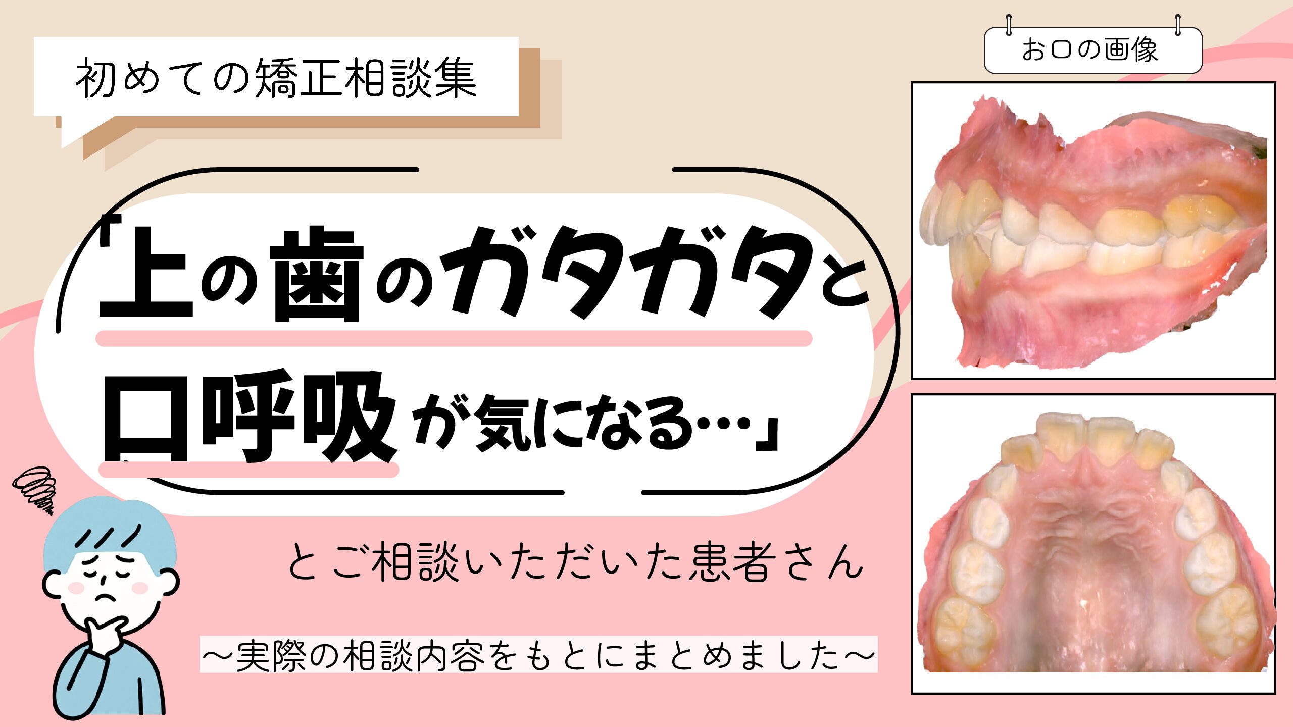 「上の歯のガタガタと口呼吸が気になる…」とご相談いただいたR.Tさん（9歳・男の子）のケース