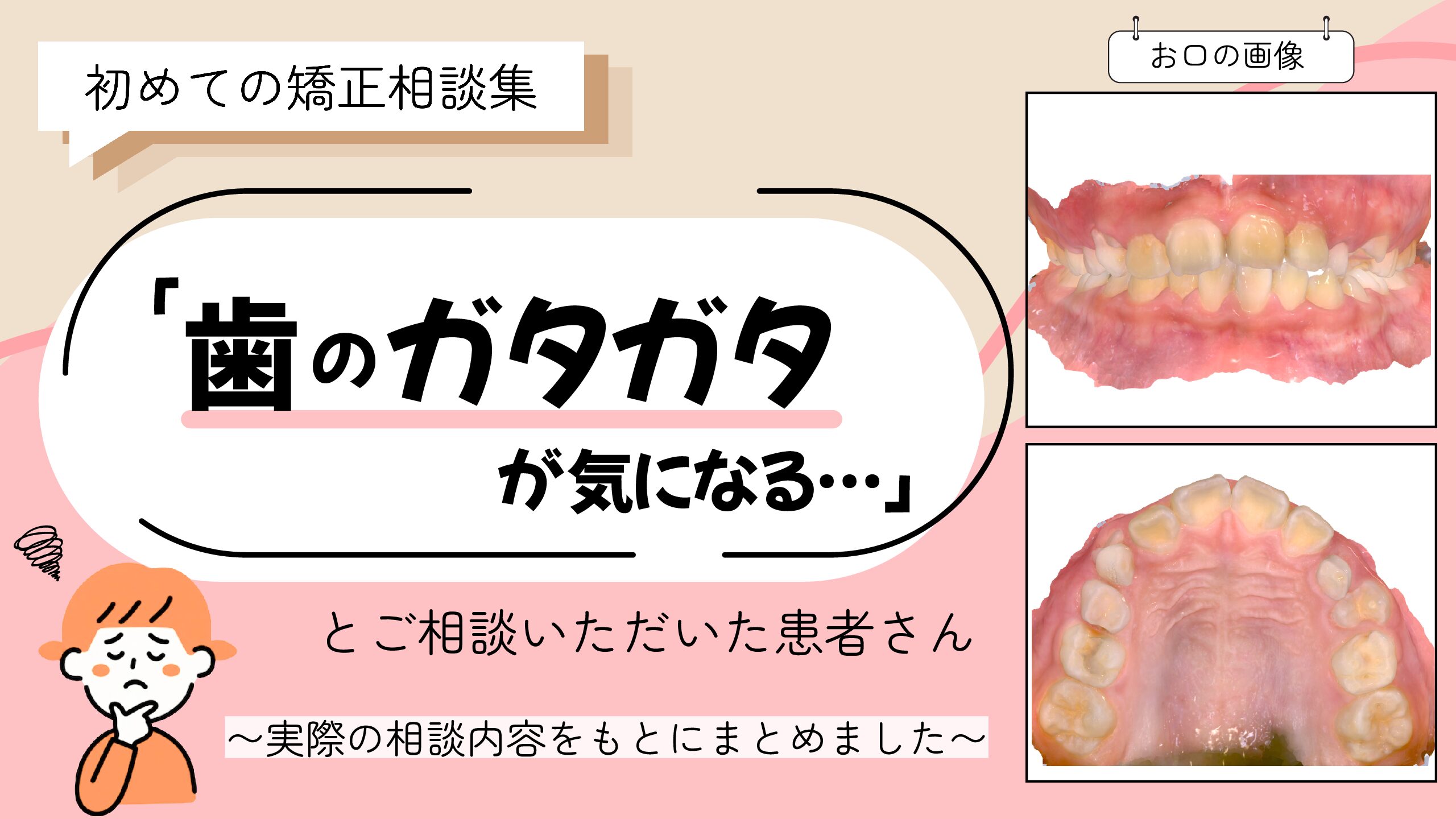 「歯のガタガタが気になる…」とご相談いただいたS.Nさん（10歳・女の子）のケース