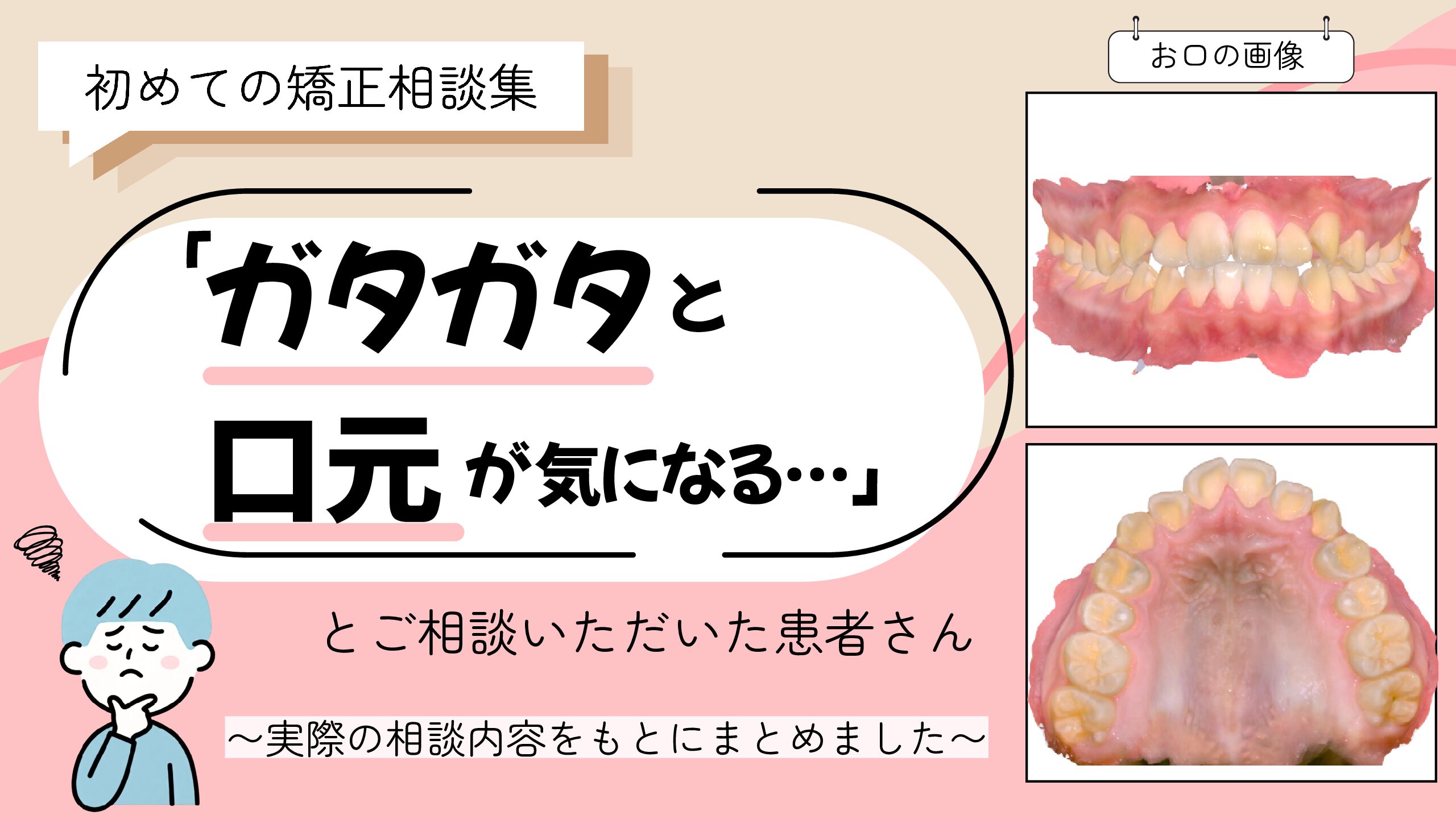 「ガタガタと口元が気になって…」とご相談いただいたS.Oさん（12歳・男の子）のケース