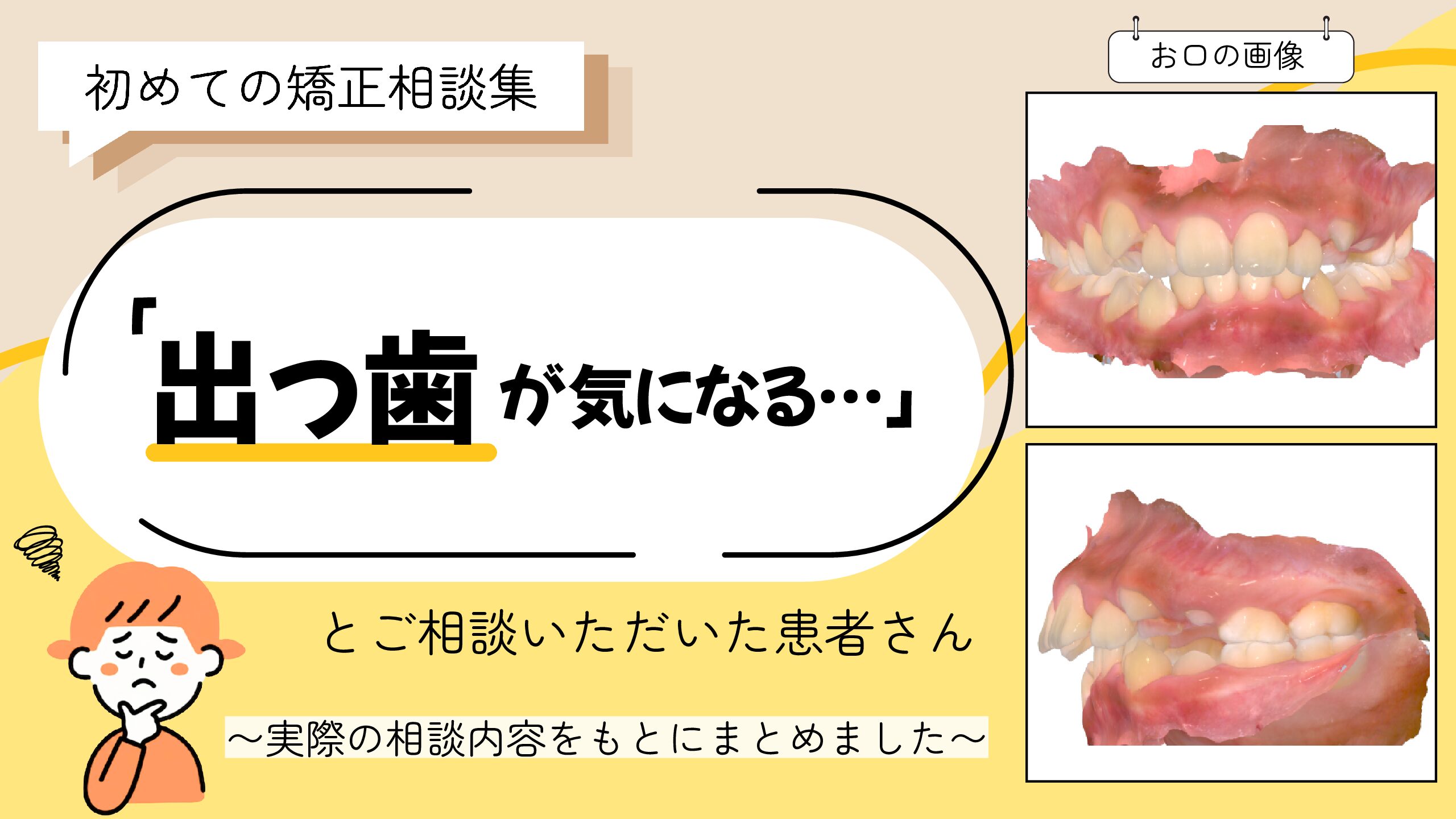 「出っ歯が気になる…」とご相談いただいたY.Iさん（10歳・女の子）のケース