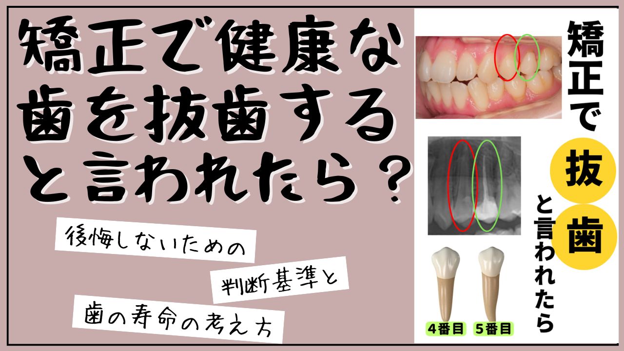 矯正で健康な歯を抜歯すると言われたら？後悔しないための判断基準と歯の寿命の考え方