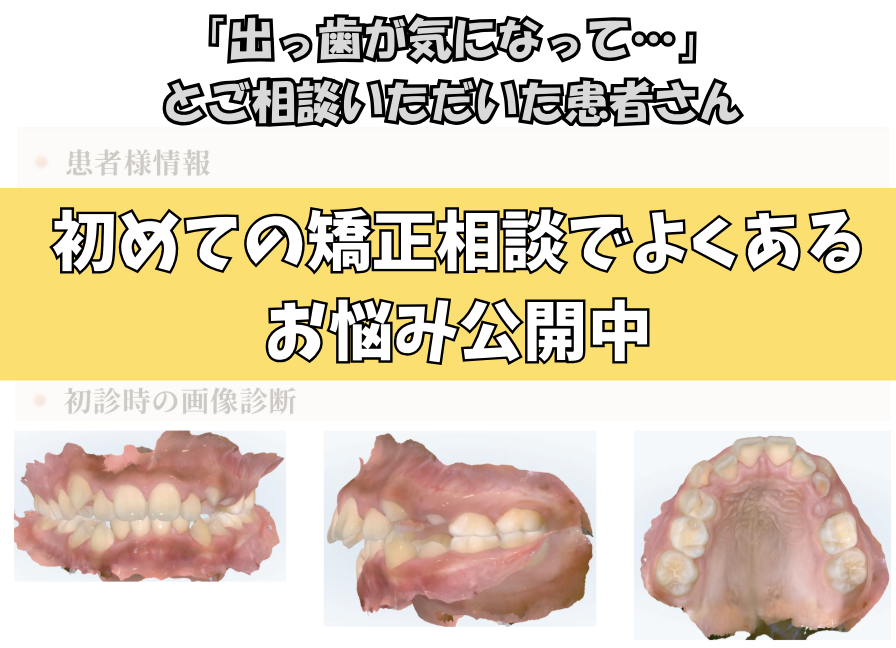 「出っ歯が気になって…」とご相談いただいたY.Iさん（10歳・女の子）のケース