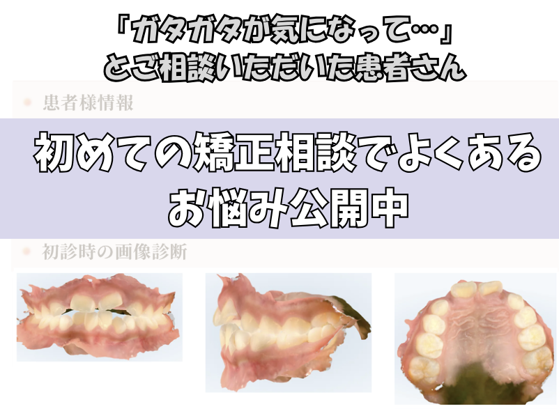 「ガタガタが気になって…」M.Iさん（7歳・女の子）のケース