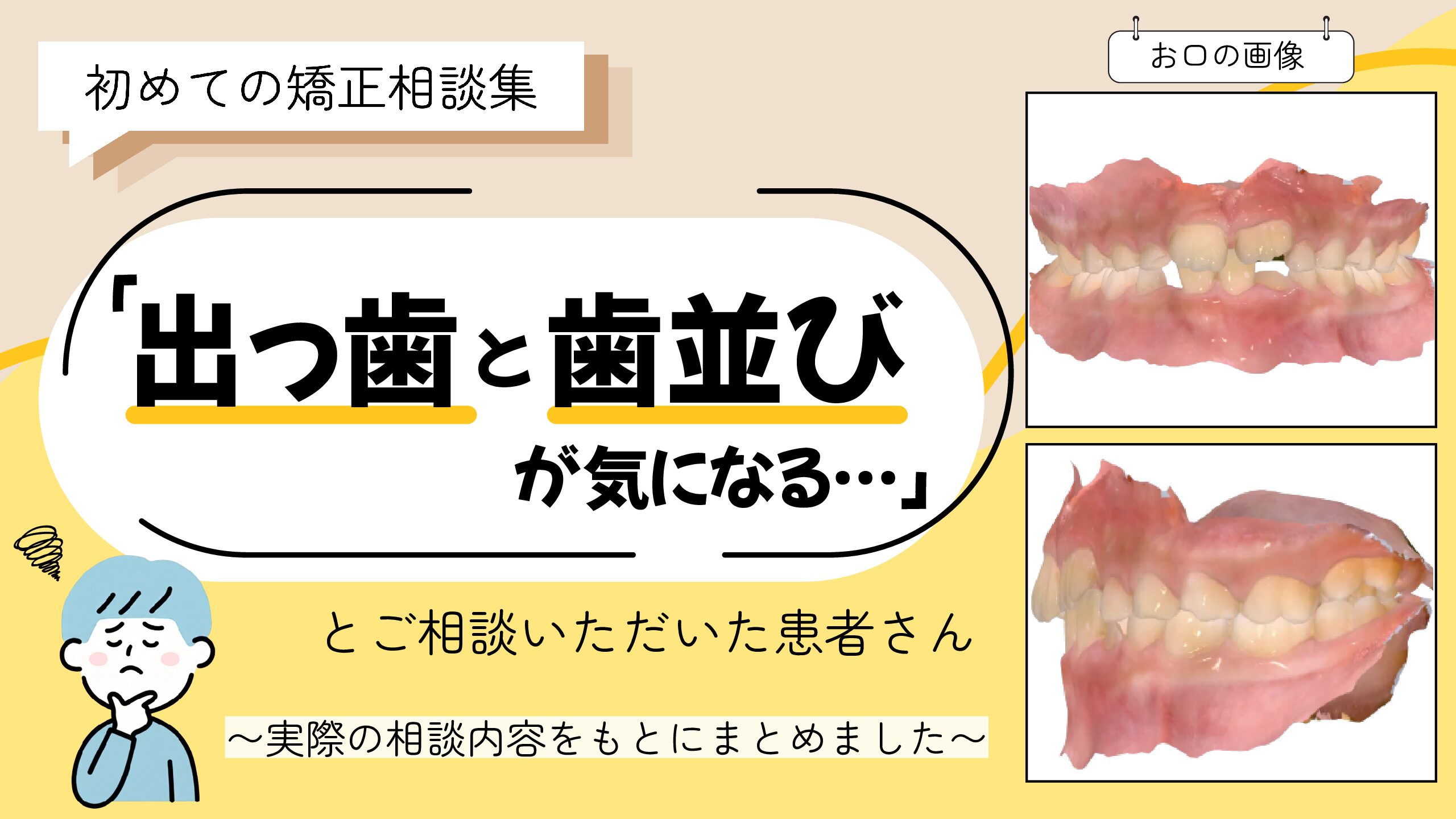 「出っ歯と歯並びが気になる…」とご相談いただいたA.Hさん（8歳・男の子）のケース