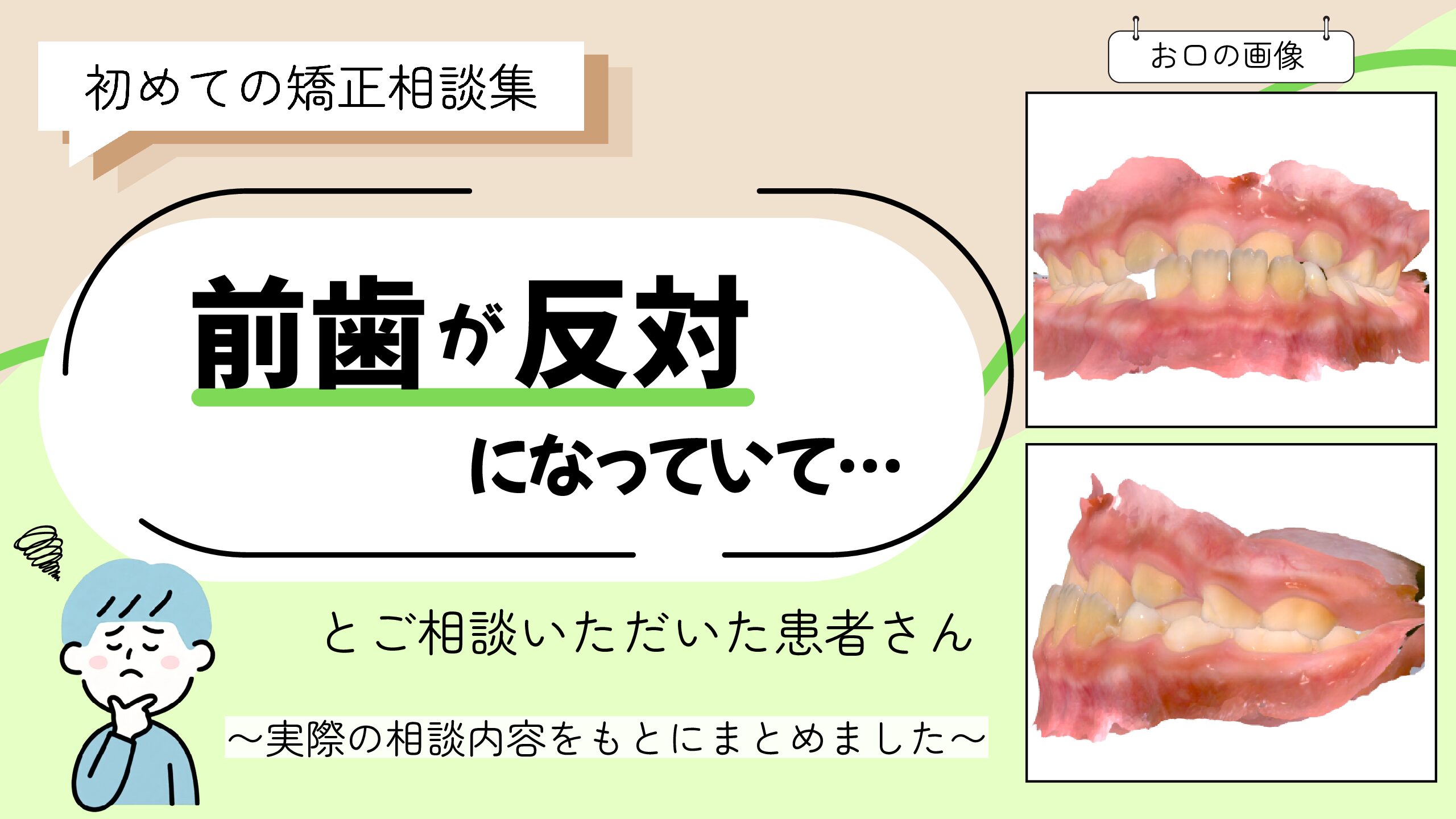 「前歯が反対になっていて…」とご相談いただいたA.Hさん（9歳・男の子）のケース