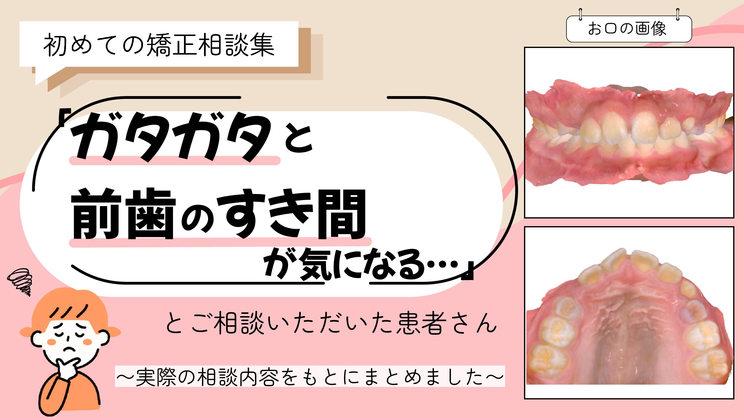 「ガタガタと、前歯のすき間が気になる…」とご相談いただいたH.Tさん（9歳・女の子）のケース