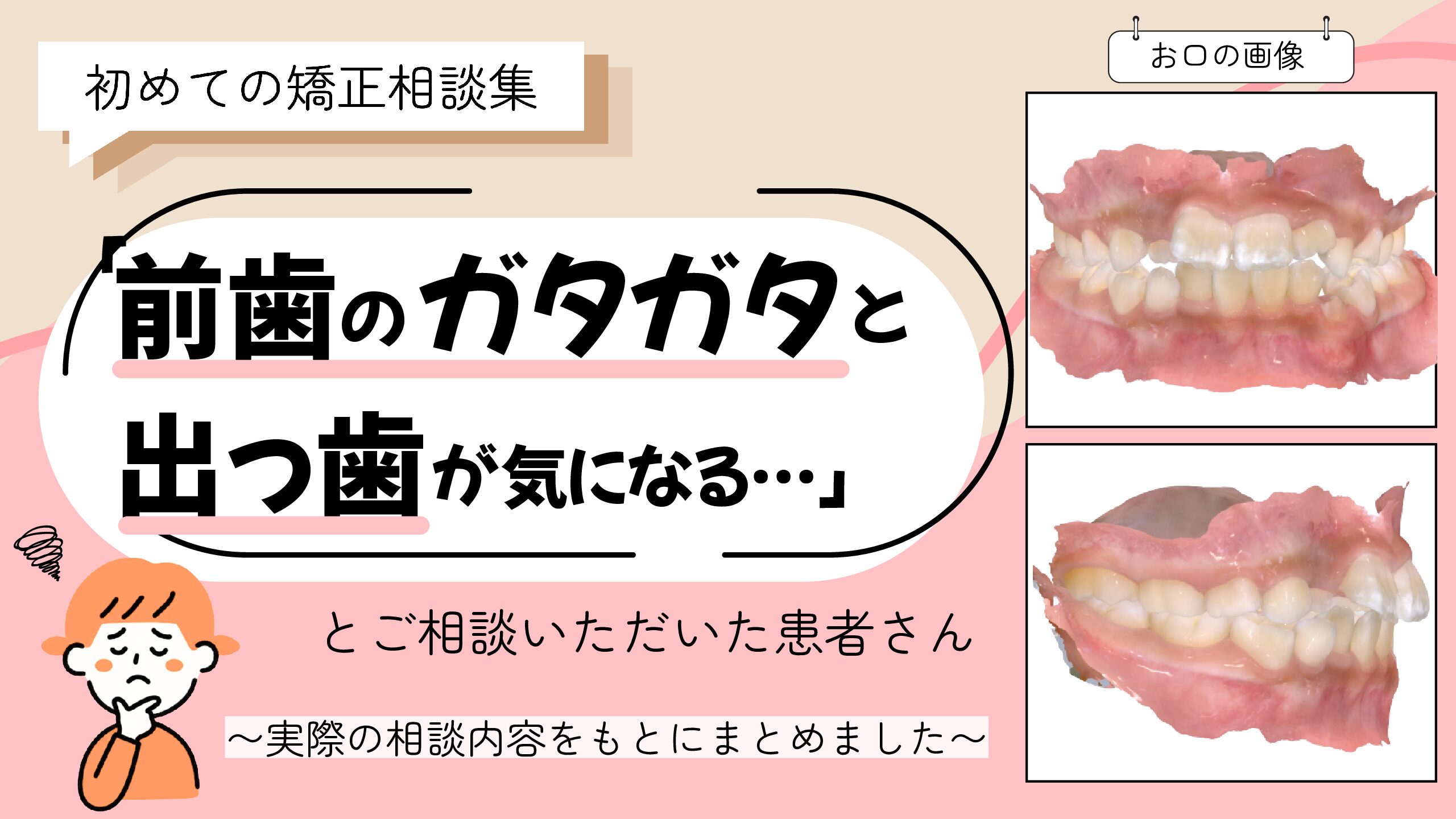 「前歯のガタガタと出っ歯が気になる…」とご相談いただいたK.Aさん（8歳女の子）のケース