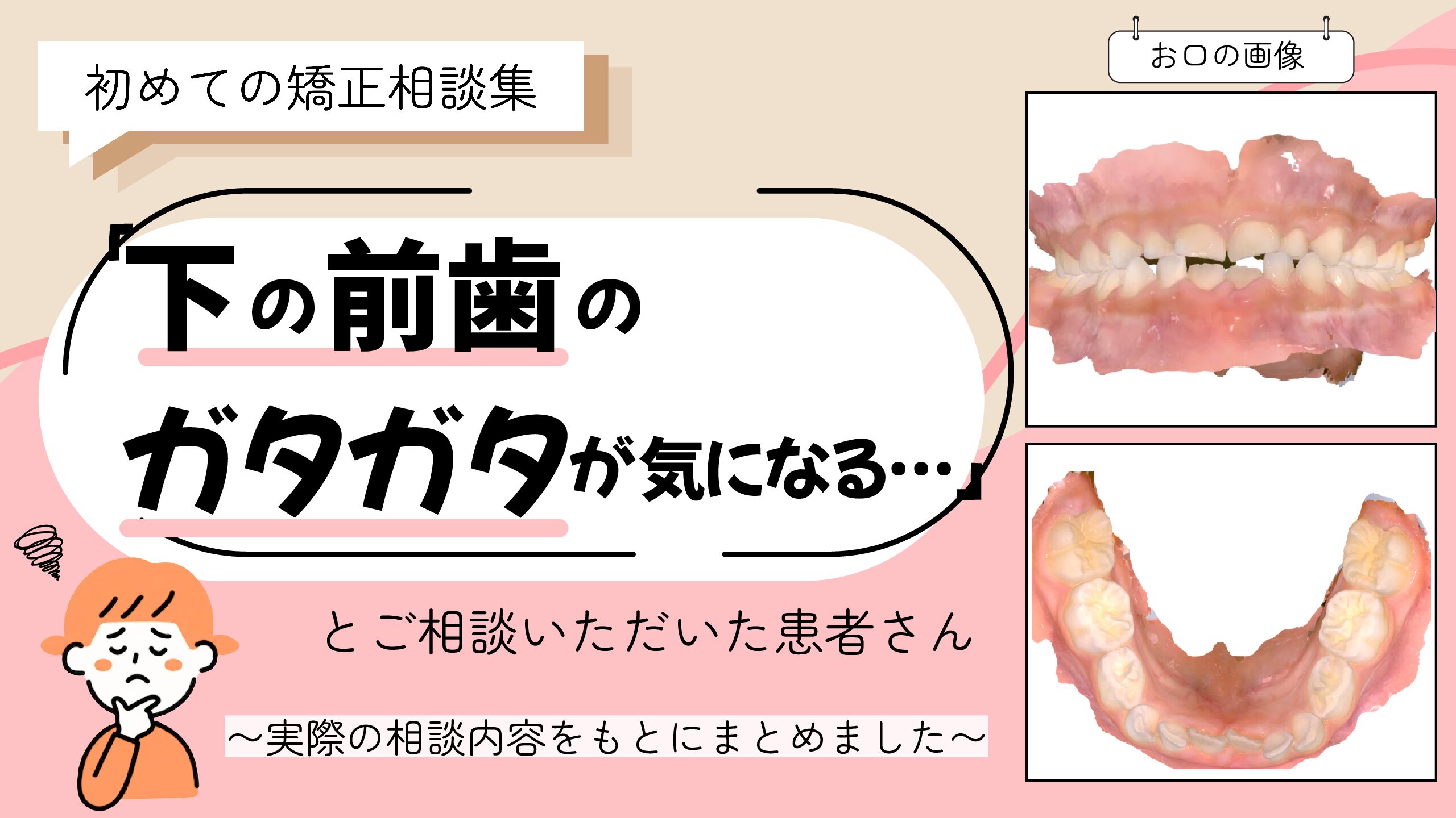 「下の前歯のガタガタが気になる…」とご相談いただいたN.Nさん（７歳・女の子）のケース