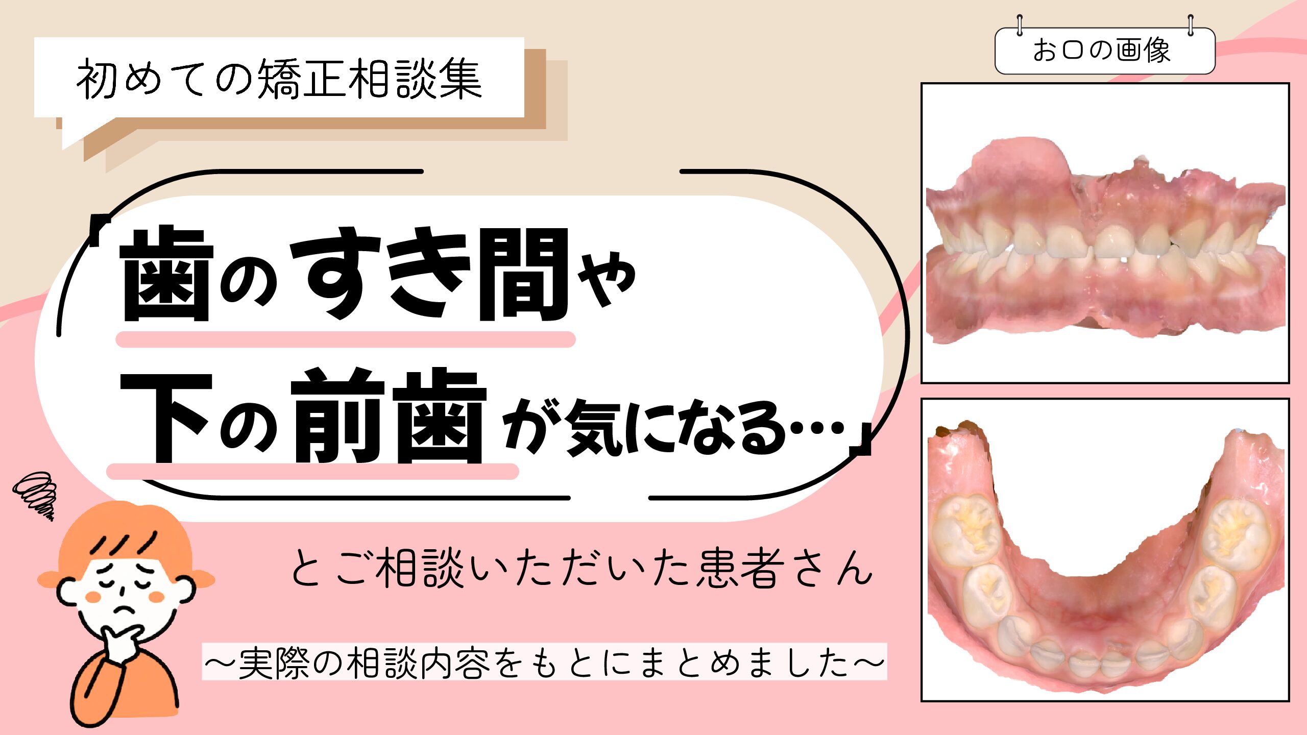 「歯のすき間や下の前歯が気になる…」とご相談いただいたS.Kさん（5歳・女の子）のケース