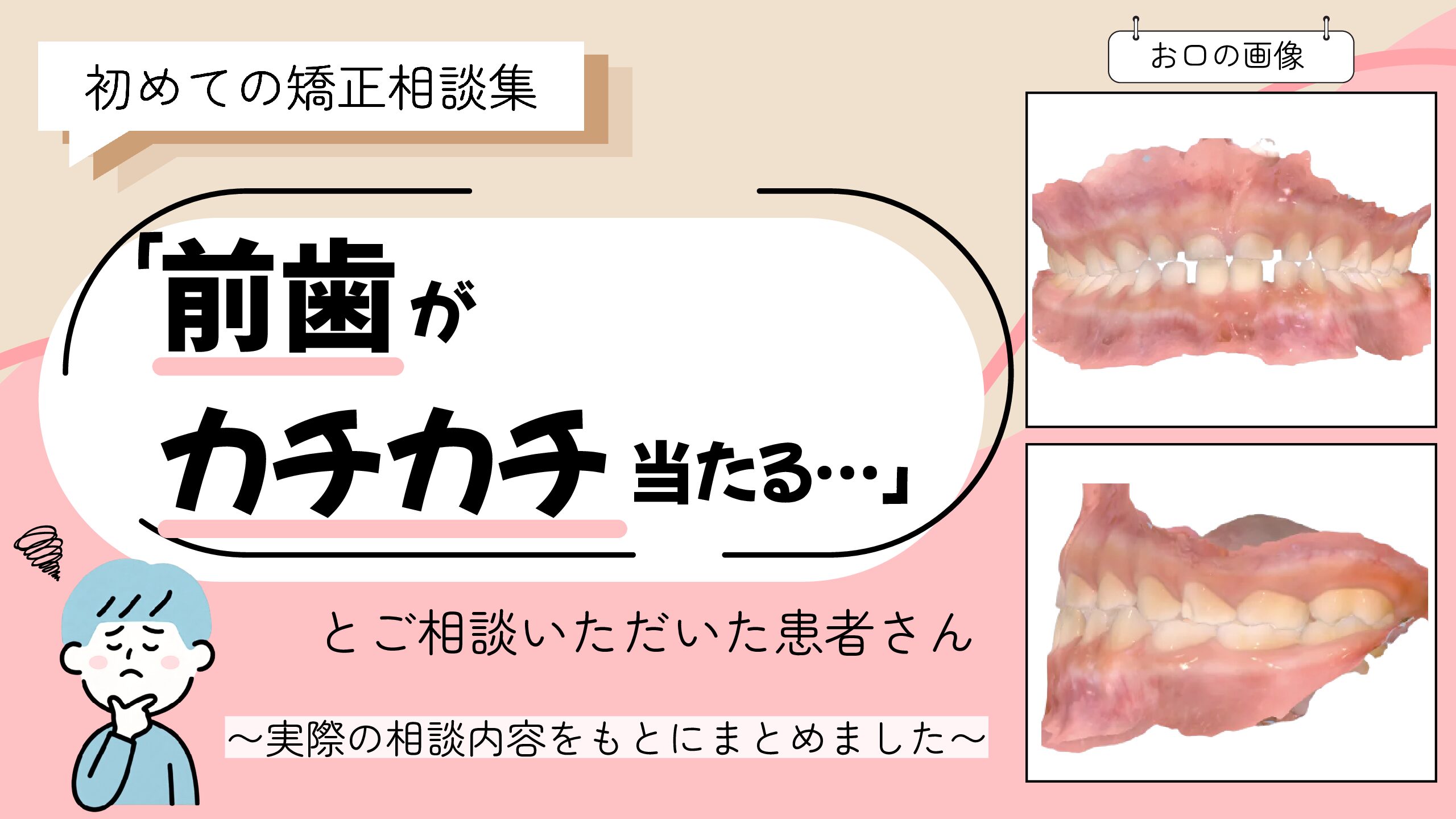 「前歯がカチカチ当たる…」とご相談いただいたS.Mさん（6歳・男の子）のケース