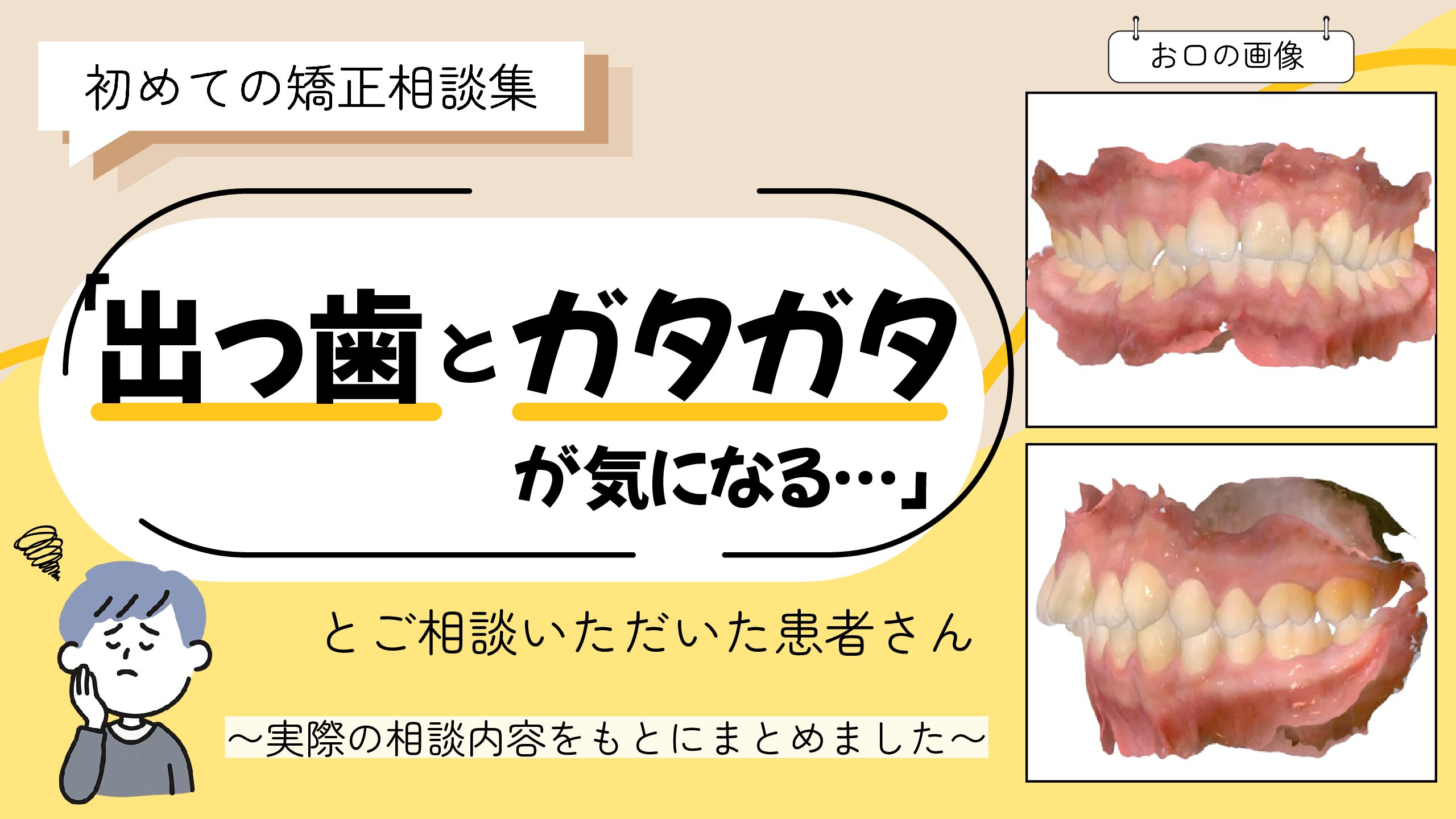 「出っ歯とガタガタが気になる…」とご相談いただいたY.Eさん（16歳・男性）のケース