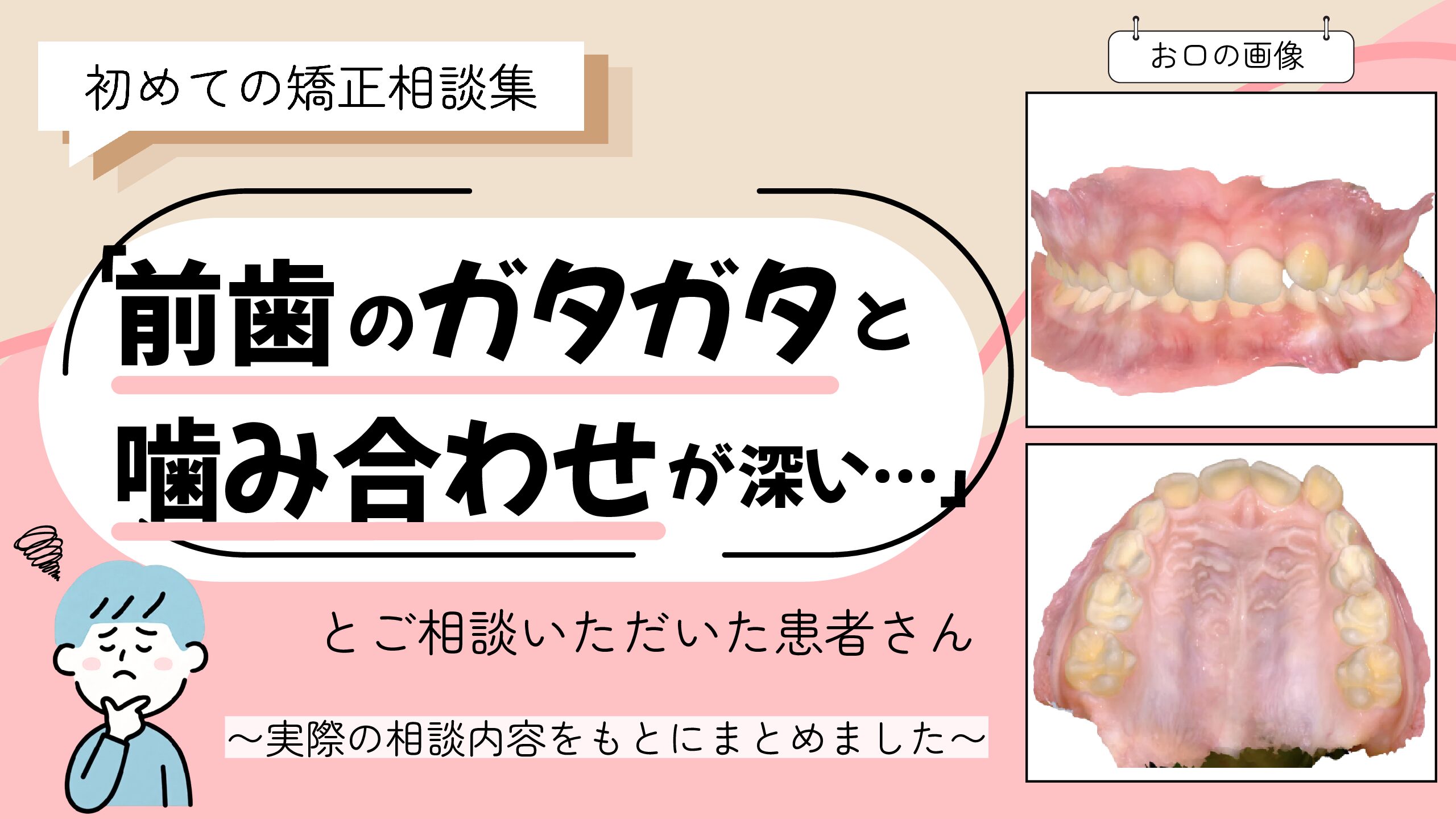 「前歯のガタガタと噛み合わせが深い…」とご相談いただいたH.Sさん（9歳・男の子）のケース