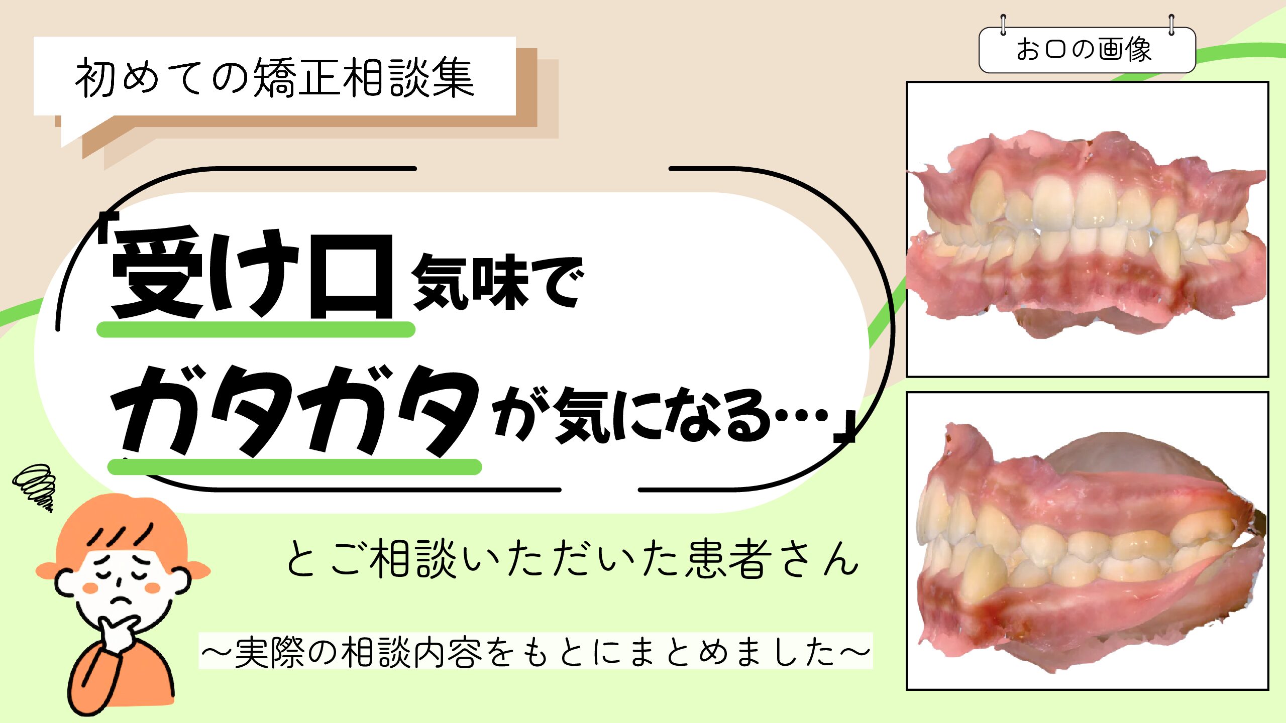 「受け口気味でガタガタが気になる…」とご相談いただいたH.Tさん（13歳・女の子）のケース