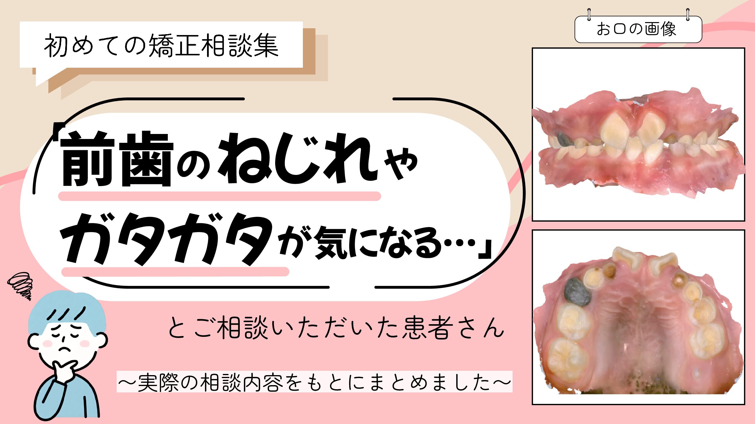 「前歯のねじれやガタガタが気になる…」とご相談いただいたH.Yさん（8歳 ・男の子）のケース