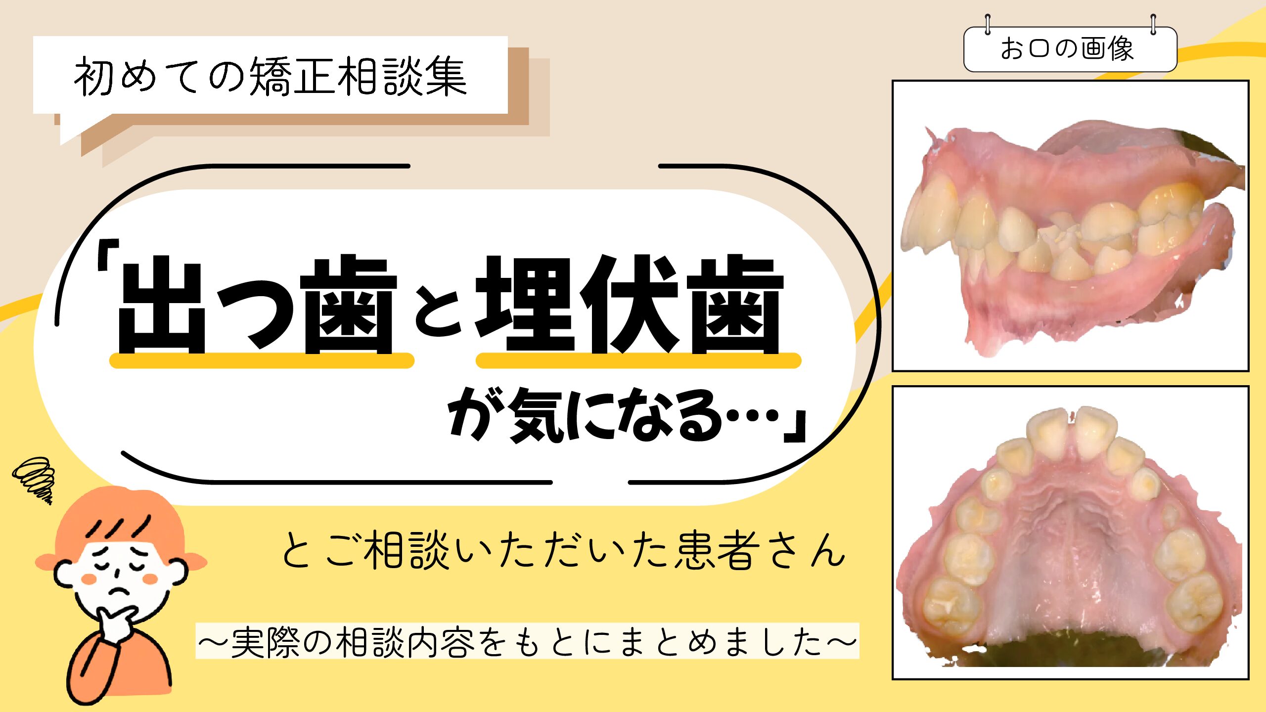 「出っ歯と埋伏歯が気になる…」とご相談いただいたH.Wさん（11歳・女の子）のケース