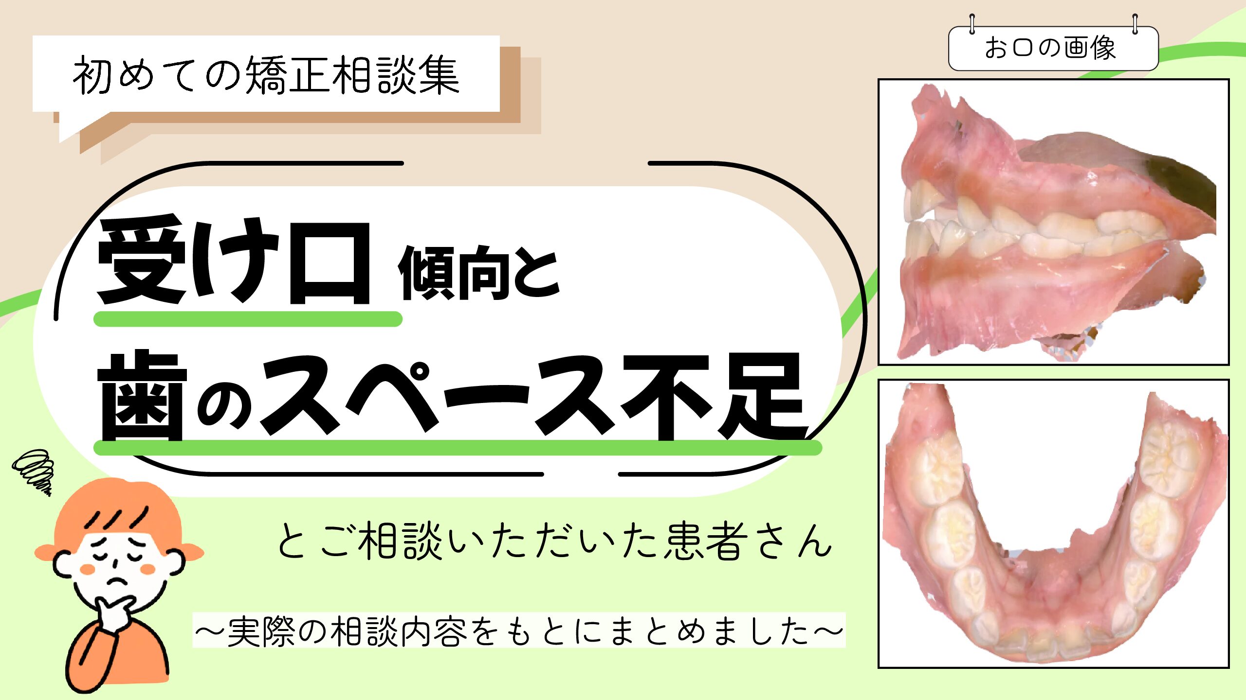 受け口傾向と歯のスペース不足についてご相談いただいたJ.Oさん（6歳・女の子）のケース