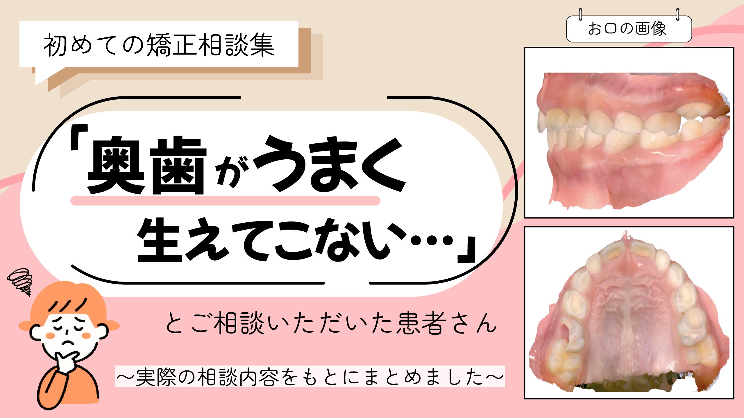 「奥歯がうまく生えてこない…」とご相談いただいたR.Sさん（6歳・女の子）のケース