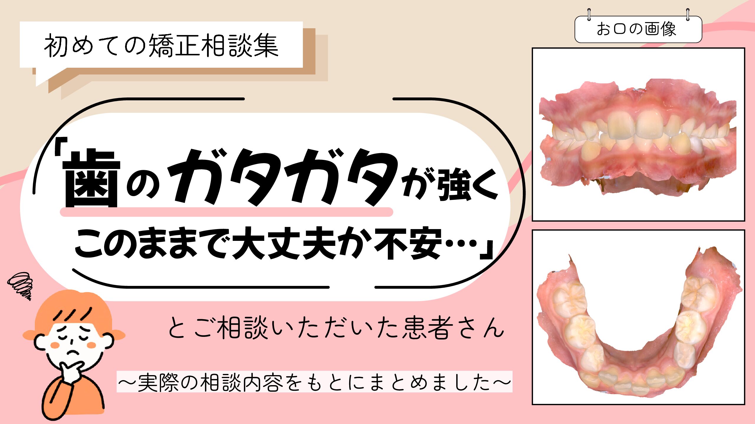 「歯のガタガタが強く、このままで大丈夫か不安…」とご相談いただいたT.Sさん（10歳・女の子）のケース