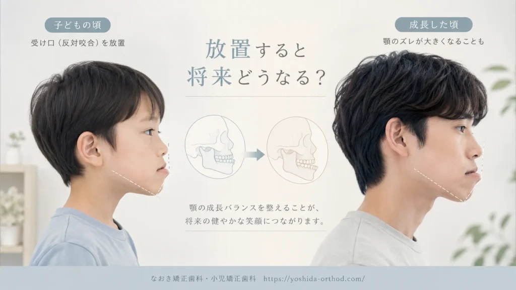 反対咬合を放置するとどうなる？