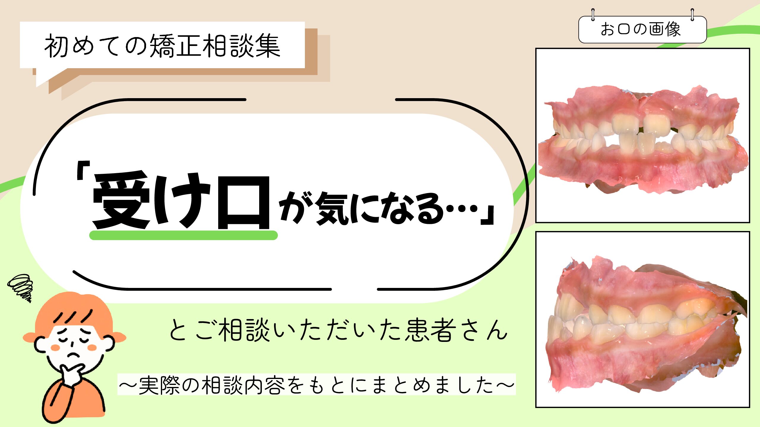 「受け口が気になる…」とご相談いただいたF.Hさん（7歳・女の子）のケース