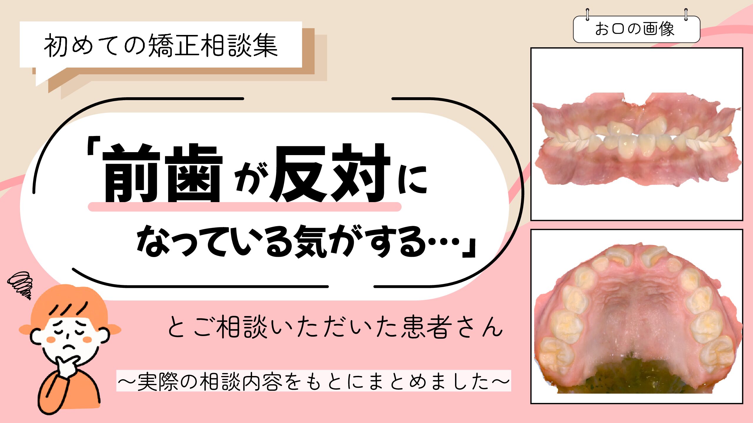 「前歯が反対になっている気がする…」とご相談いただいたA.Kさん（7歳・女の子）のケース