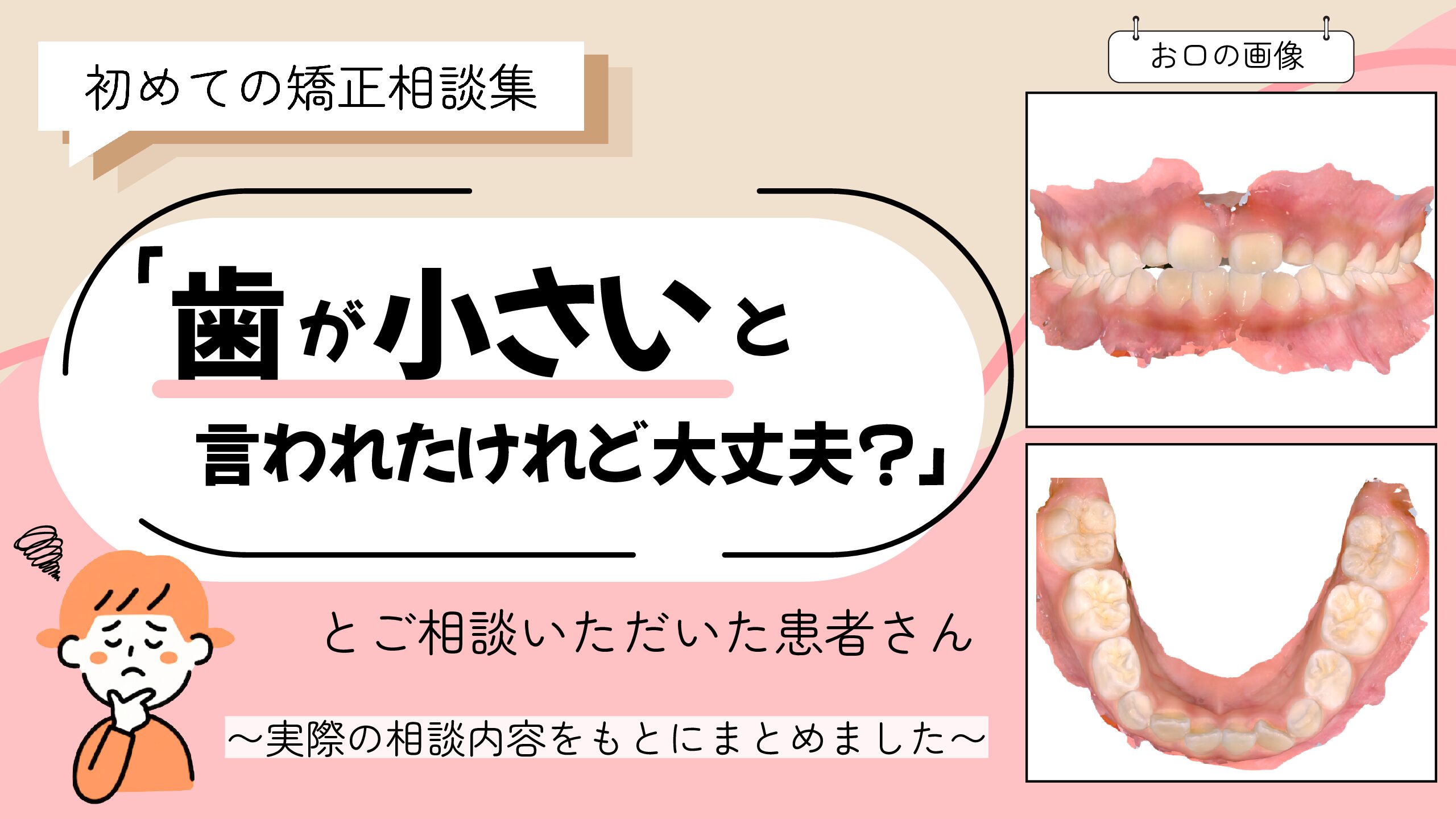 「歯が小さいと言われたけれど大丈夫？」とご相談いただいたS.Wさん（6歳・女の子）のケース