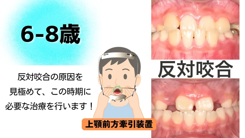 6〜8歳：永久歯の生え変わりに合わせた治療の最適時期