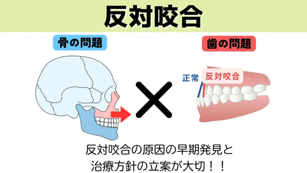 まとめ：子どもの反対咬合は早めの相談が治療の選択肢を広げます