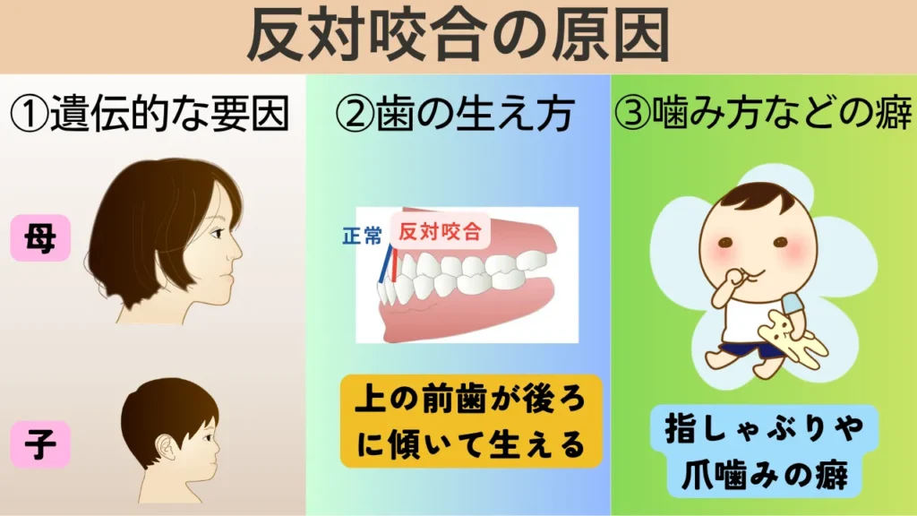 子どもの反対咬合の原因