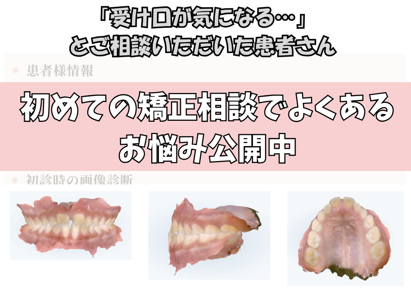 「受け口が気になる…」とご相談いただいた7歳・男の子のケース