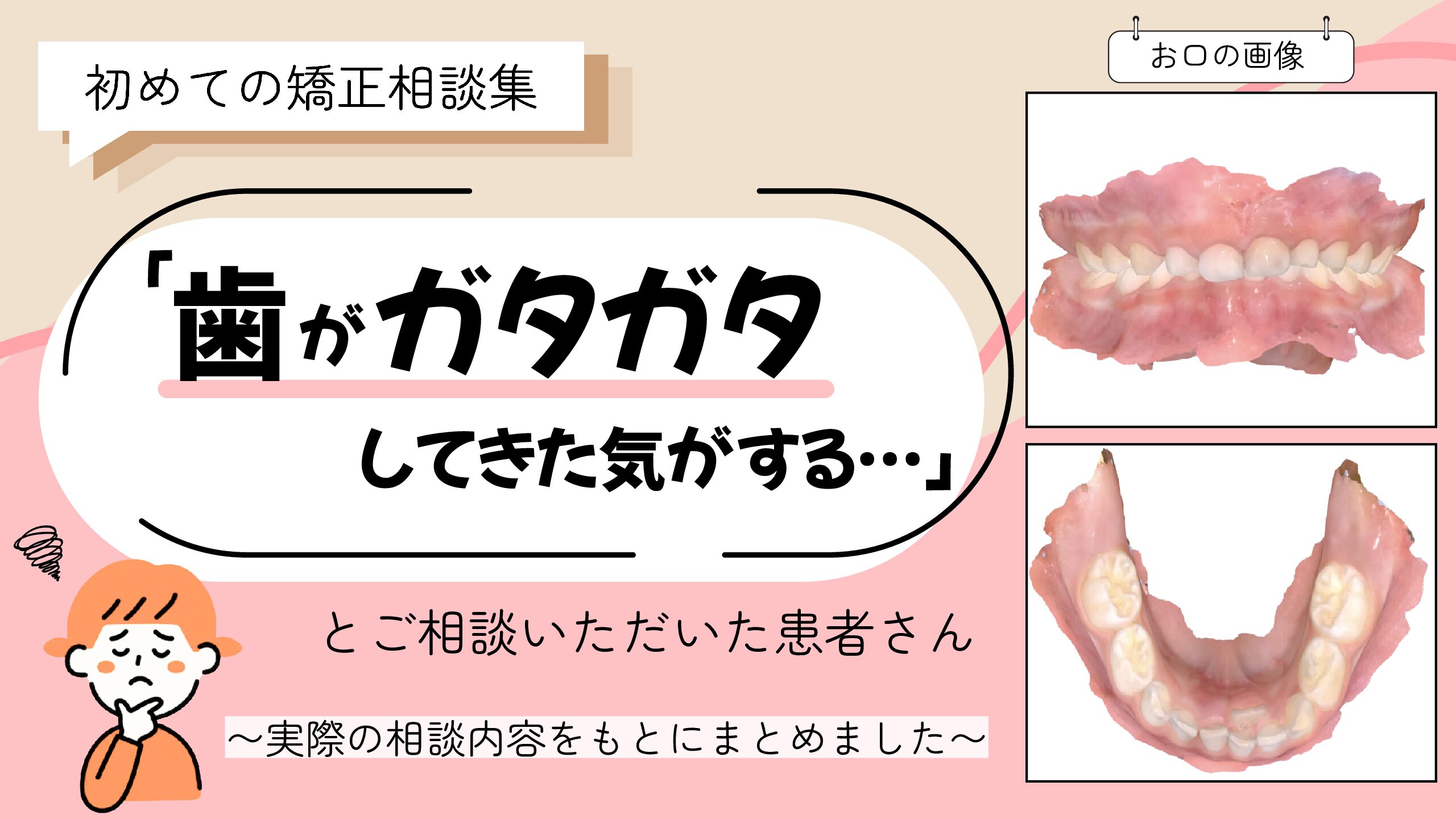 「歯がガタガタしてきた気がする…」とご相談いただいた6歳・女の子のケース