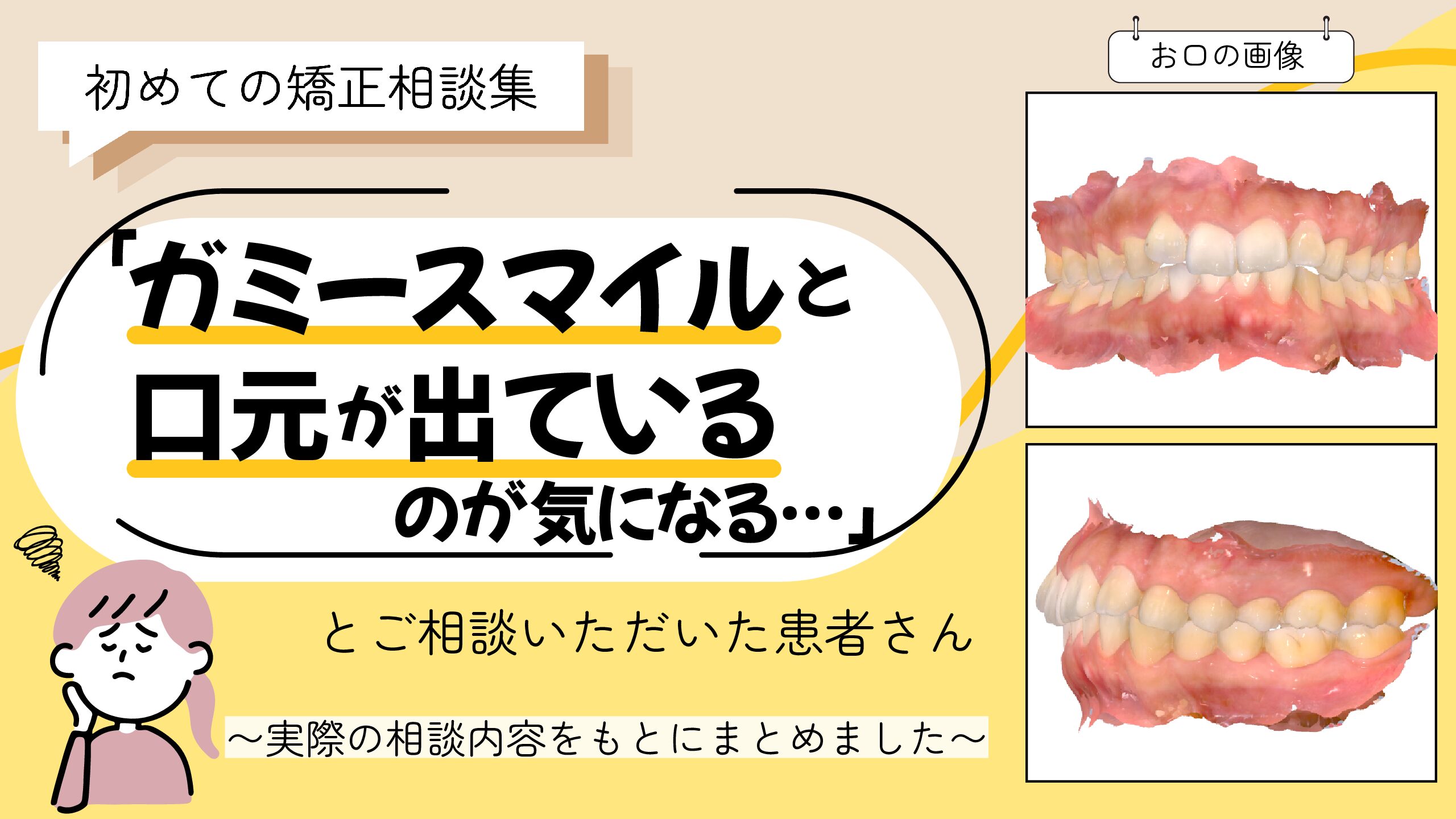 「ガミースマイルと口元が出ているのが気になる…」とご相談いただいた30歳・女性のケース