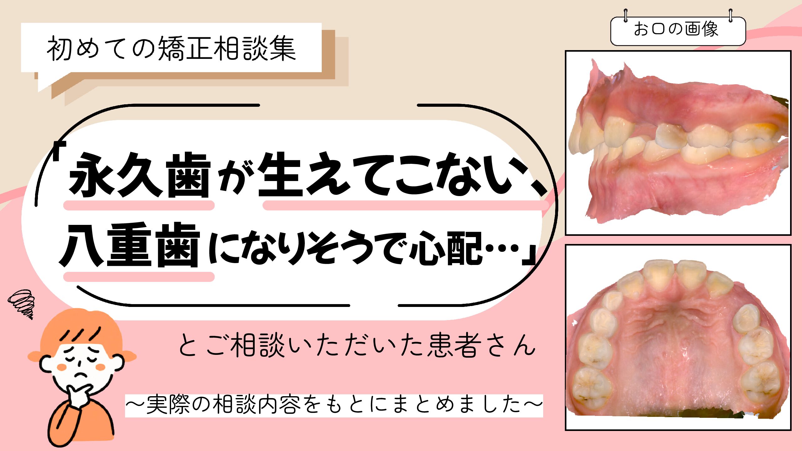 「永久歯が生えてこないのと八重歯になりそうで心配…」とご相談いただいたK.Fさん（8歳・女の子）のケース