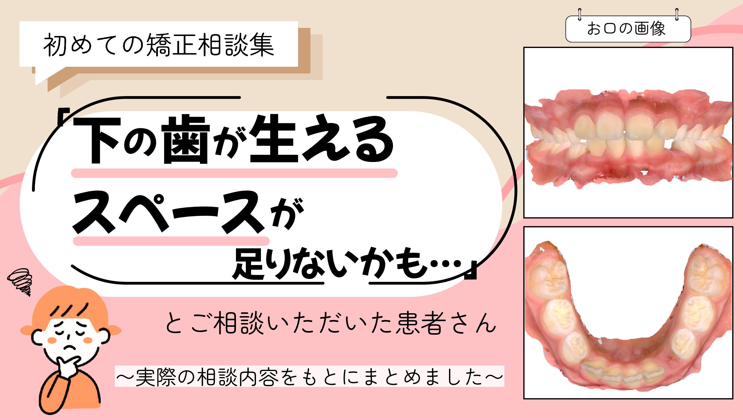 「下の歯が生えるスペースが足りないかも…」とご相談いただいたK.Mさん（8歳・女の子）のケース