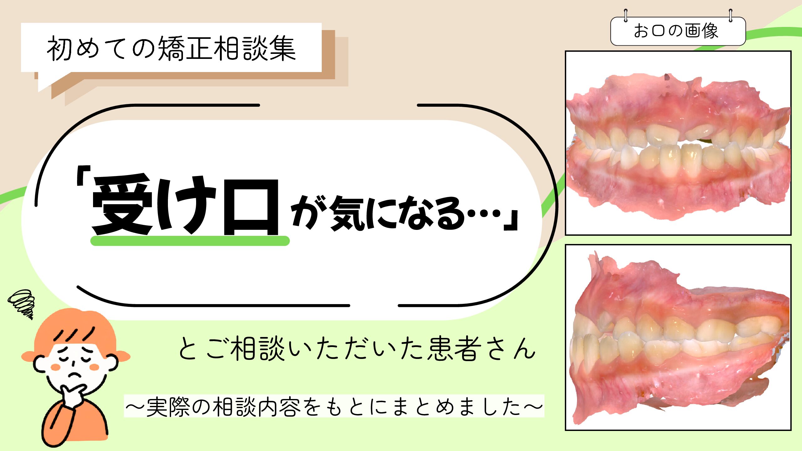 「受け口が気になる…」とご相談いただいたR.Sさん（6歳・女の子）のケース