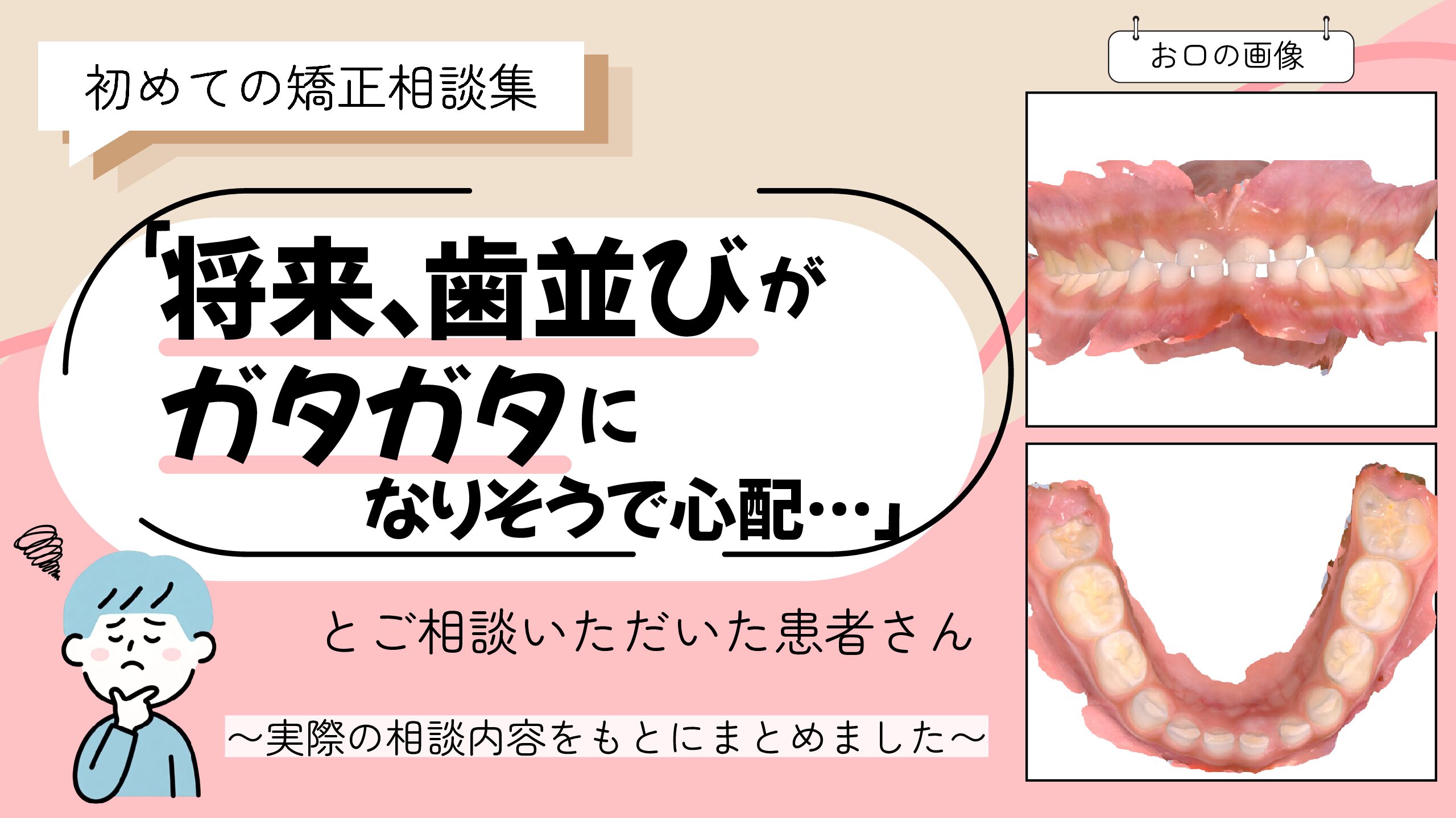 「将来、歯並びがガタガタになりそうで心配…」とご相談いただいたR.Tさん（6歳・男の子）のケース